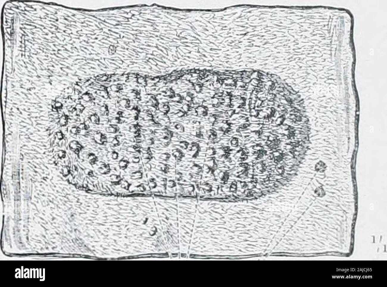 Un atlas de l'anatomie humaine pour les étudiants et les médecins . * Voir le Appendbv, remarque Fig. 724. La surface extérieure de l'MucousMembrane withBrunners du duodénum, glandes (glandes duodénales), affiché par l'élimination de la mus-culière manteau.. Agminated les glandes, ou- Peyers Noduli lympliatici aggregati (patches) Ieyeri lympliaticisolitarii Noduli glandes solitaires Fig. 725.-Noduli Lymphatici Aggre-gati, Agminated PeyersPatches, glandes, ou de l'iléon. Les cryptes ou Lieberkuhu Lieberkuhns de follicules (glandes intestinales (Lieberkuehni glandulaire) -villosités intestinales intc Villi-stin-ales Banque D'Images