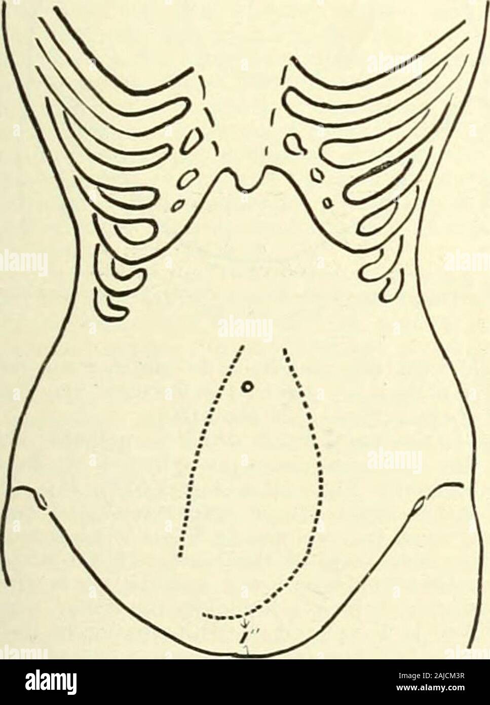 Un manuel de référence de la médecine qui englobe l'ensemble des connaissances scientifiques et pratiques de la médecine et sciences connexes . S. Il a été vu que le enteroptosis arejnostly sujets de femmes. Ceux en qui l'état est marqué. Fig. 5127.-Veitically estomac situé et descente. Situé à liyiliumiuatiou. sont habituellement grand et mince, sans aucune forme de compacité,I alors que l'expression faciale dans bien des cas, bespeaksa astlienia neui-base, et, d'après Keith antl-Wil liams, en facilite de ptose viscérale, il est communément aI marquée à l'avant de la courbure de la région cervicale de thej Banque D'Images