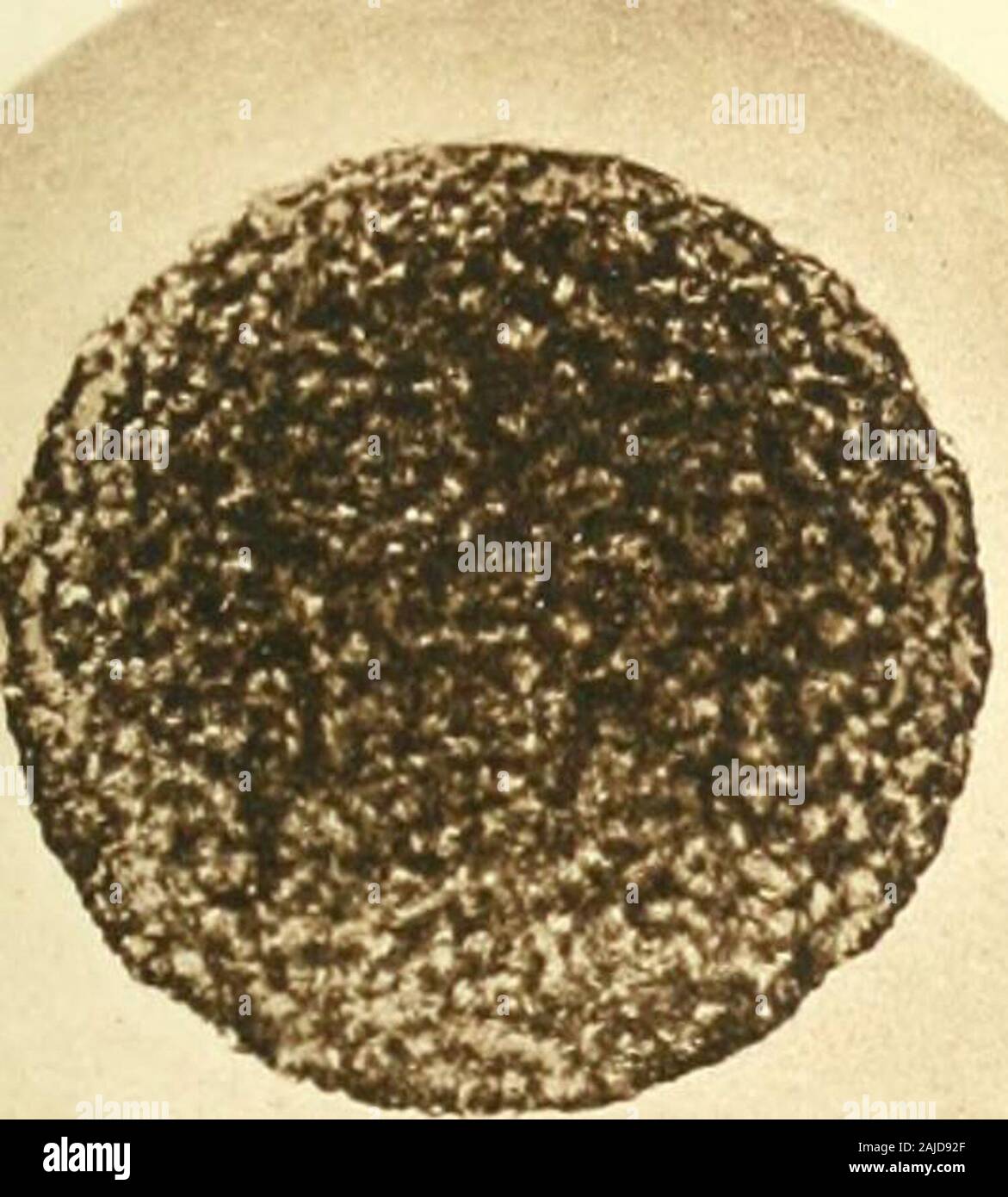 Un manuel de référence de la médecine qui englobe l'ensemble des connaissances scientifiques et pratiques de la médecine et de la science alliée . riG.j. c&gt ;,.-^S !S^^ ae6 FIG.2.. J'»{ FIG.3. FIG.4  3 IDAY DAVS 4 Diors 5 jours 7 jours 10 jours  ?9 mn Hi^^Bfll j'^^^^^^H Sil frapper IH IHhI BI H^l ^1 ^^^n HH H^^^^^^^l ^^^^V P^ ^^^^J H H HH 1 Dans ? ^^^9 H;H H H "^ 1.  -&gt;j.ti-"- ?y ^^i.J, O^^ « Q) fIG.5. Choléra asiatique. CULTURES ET COUVERCLE EN VERRE VITRAIL -PPEPABATIONS .( A.PRÈS KOCH ET GAFFHY. Manuel de référence J'JIEDICAL THK SCIENCES. (Asialif liolera Aslutir.le choléra. quatre heures les cultures sont refroidis, et de deux à f Banque D'Images