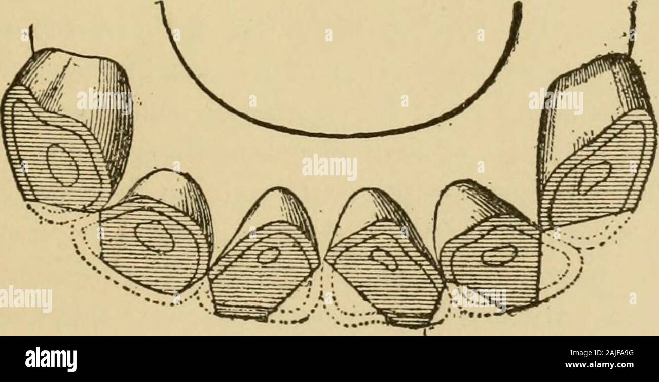 L'extérieur de l'intervalle d'échelle de l'cheval . entre ces incisives, les coins ayant preservedtheir longueur normale et le contact. En d'autres temps, le raccourcissement peut affecter toutes les dents de la même arcade,et puis il peut, même si perçus, au moins ne pas être attribuée à l'encoffrement, ifwe sont ignorants des relations de cause à effet qui relient cette varietyof l'usure avec le cercle vicieux de l'habitude comme caractère de ce qui nous peut être consulté. Voici les trois cas possibles que nous avons remarqué : a. Le shortening^ n'affecte que les dents de la mâchoire supérieure (B). b. Il n'affecte que tho Banque D'Images