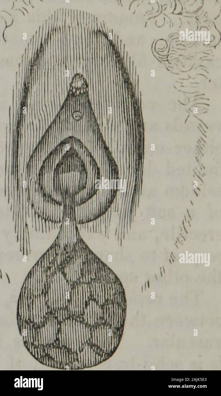 Éléments d'anatomie pathologique . Fig. 230. 1 , &Lt ; . les excroissances morbides est surtout comme de poire ; et, bien qu'ils peuvent être originaires d'anyportion de la cavité de l'utérus, ils sont le plus souvent attachées à itsneck. Beaucoup d'entre eux ont un pédoncule mince, étroite ; et, dans ce que sont la taille, ofgreat il n'est pas rare de voir des fentes profondes, ce qui leur donne un lobulatedarrangement. Chacune des trois espèces que nous avons décrit est investedby une fine muqueuse, qui est plus ou moins vasculaire, et qu'un pro-longation de celle de l'utérus, immédiatement au-dessous de laquelle la croissance est manifeste élaboré morbide Banque D'Images