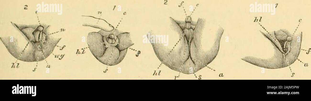 Un système de gynécologie . tendant à la sortie du cloaque, le soi-disant geni-tal sillon. À partir de la cinquième à la dixième semaine le cloaque devient de Sepa, comme décrit ci-dessus, en une partie antérieure ou le sinusurogenitalis urogénitales, et une partie postérieure ou rectale. Jusqu'à la dixième semaine thesexes ne peuvent être distingués, mais désormais les particularités de l'eachappear. Les replis génitaux croître pour devenir le majora de labia ;3 les bords de 1 Bien qu'il serait agréable de l'esthétique et le sens moral de mettre ce wordin une relation particulière à l'Hymen, le dieu du mariage, cela signifie simplement une membrane( Banque D'Images