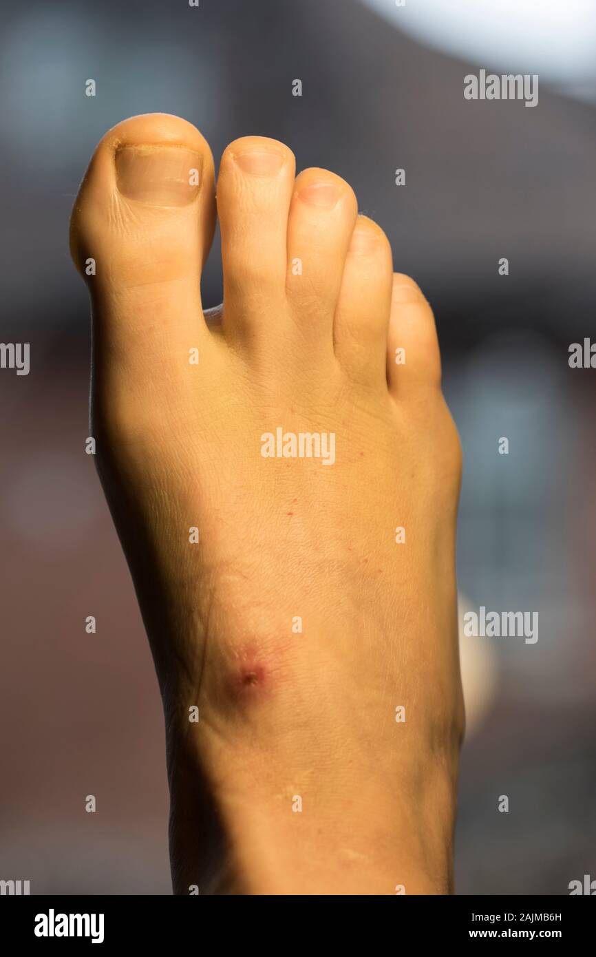 Pied Casse Banque D Image Et Photos Alamy Pied Casse Banque D Image Et Photos Alamy
