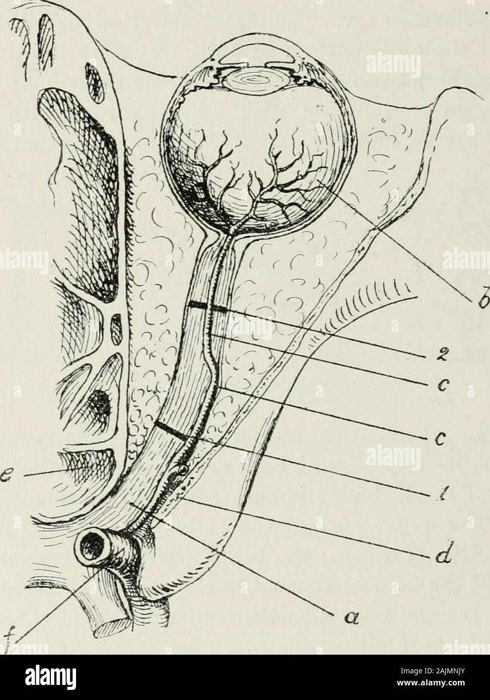 L'American encyclopédie et dictionnaire de l'ophtalmologie édité par Casey d'un bois, assistée par un personnel nombreux de collaborateurs . theorbital l'empreinte, qui est de forme pyramidale. Les murs de cette cavityare formé par pas moins de sept os, à savoir, le maxillaire supérieur,frontale sphenoid, malar, palais, ethmoïde, et lacrymale. L'innerwall, très fine, sépare la cavité orbitaire de l'ethmoidcells et le sinus sphénoïdal ; elle est formée par le processus d'thesuperior nasal maxillaire, le processus interne de l'angulaire, le osplanum frontale de l'ethmoïde, l'os lacrymal, et le corps Banque D'Images