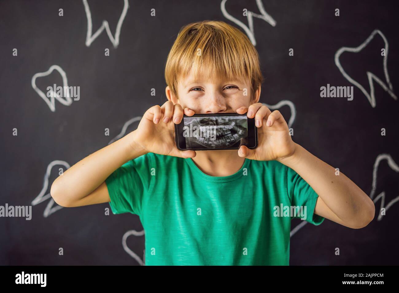 Le garçon montre son X-ray image de ses dents avec un très étrange anormalement dent. Pour l'art dentaire. Orthodontiste Patient Banque D'Images