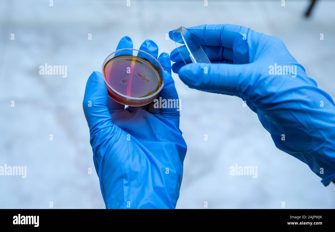 La recherche de bactéries. La culture microbiologique Banque D'Images