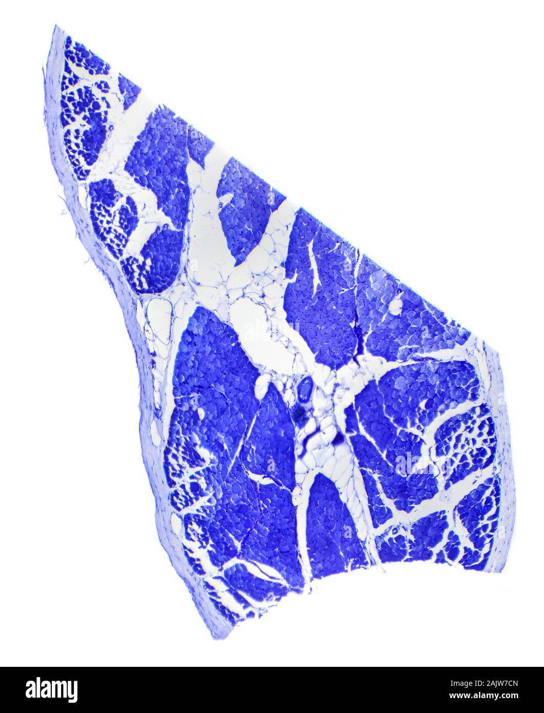 Le tissu musculaire squelettique section longitudinale sous un microscope, muscle squelettique L.S. Banque D'Images