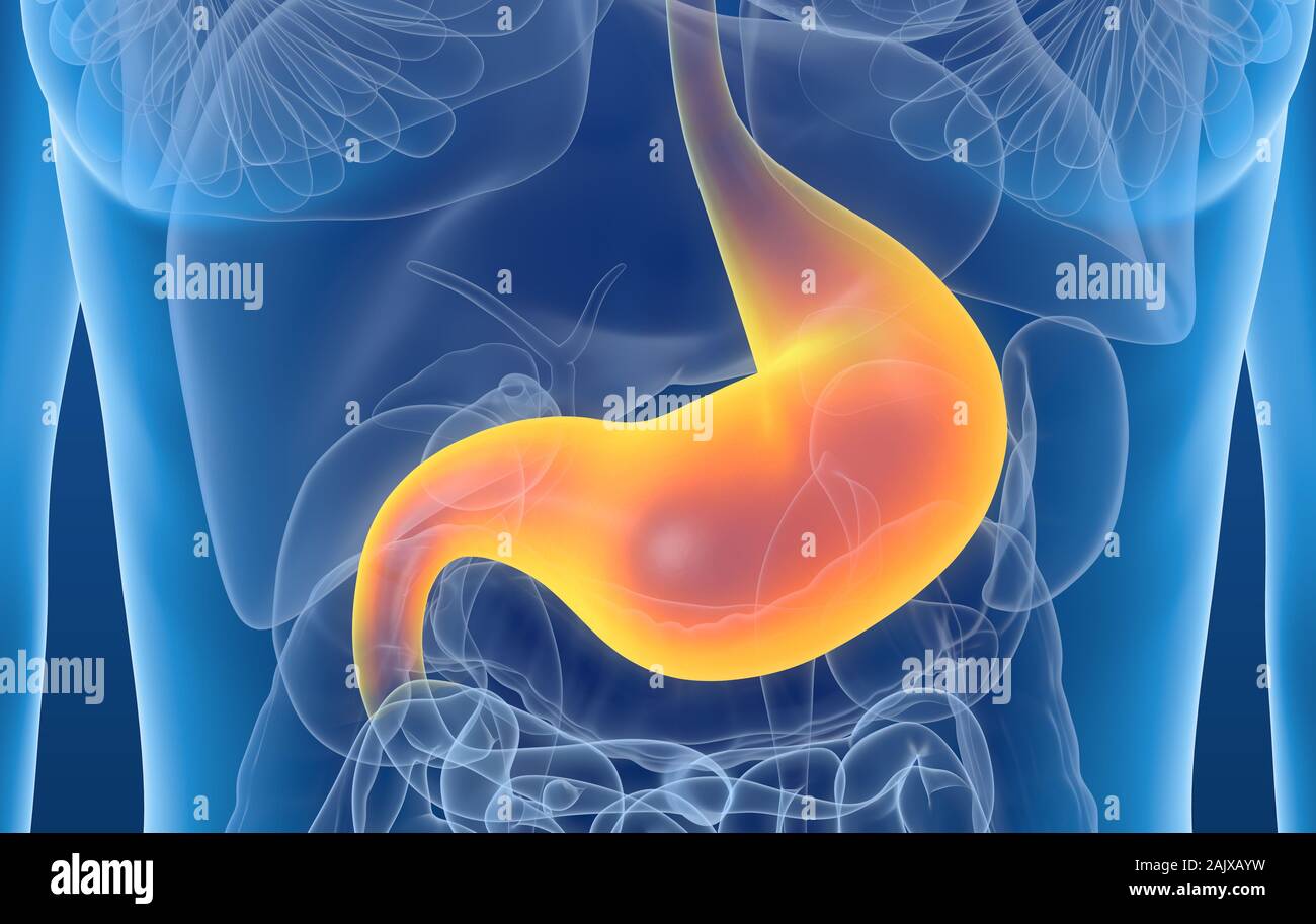 3D Illustration montrant l'estomac douloureux, gastrite Banque D'Images