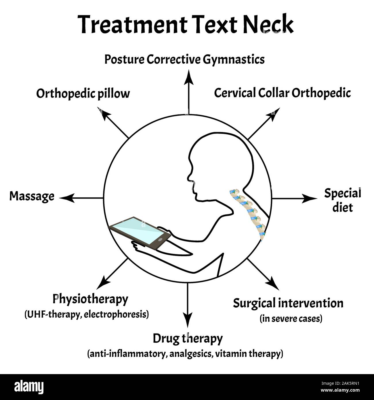 Traitement pour le syndrome du cou du texte. La courbure de la colonne vertébrale, la lordose cyphose, du cou, scoliose, arthrose. Une mauvaise posture et de Stoop. L'INFOGRAPHIE Illustration de Vecteur