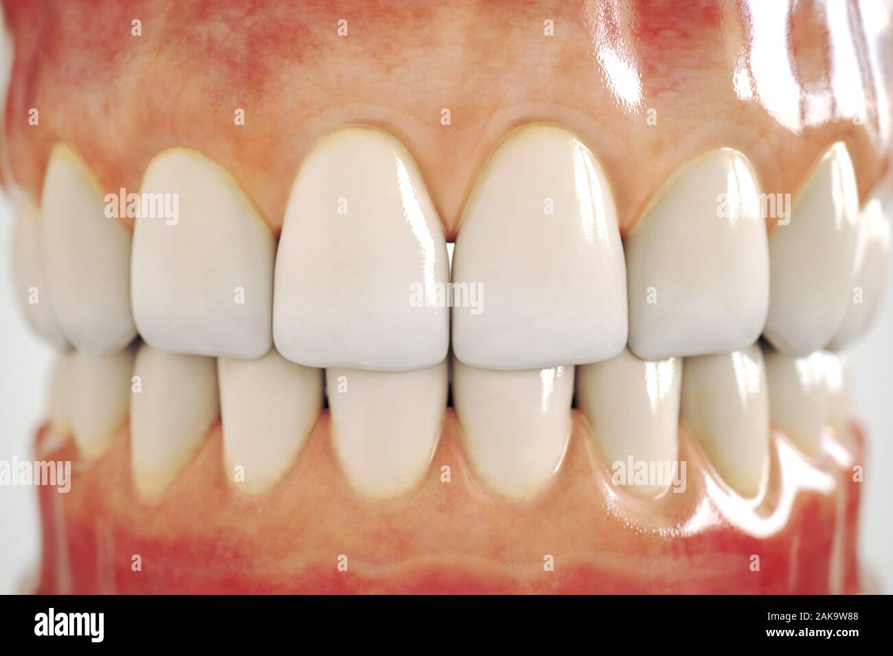 Implant dentaire invisible sur fond blanc - le rendu 3D Banque D'Images