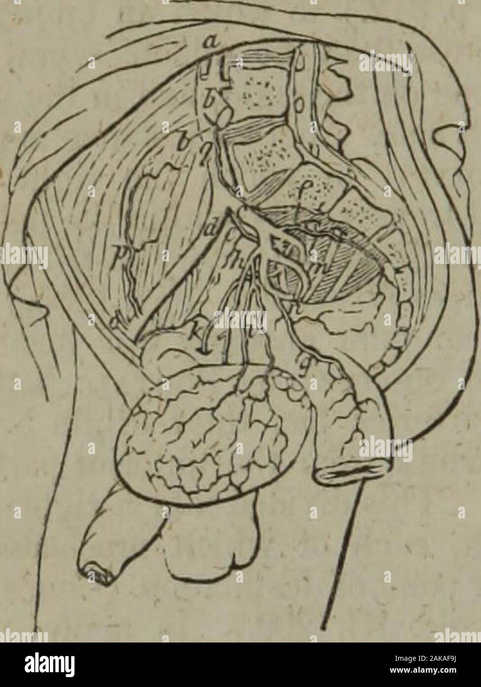 Essais sur la médecine pratique et de la chirurgie (Volume 2) ar-eacli . hich tery était double. (Scltene Beobacht. 1.101.) Les artères lombaires. L'ano-malies principal de la artères lombaires consistent dans l'origine de deux ou plusieurs d'entre eux par « tronc. Dans certains cas, quand l'artère intercostale theinferior est très grand, itsupplies au lieu de la première ; lombaire etdans la même manière, le issometimes lombaire inférieure fournie par l'ilio-lombaire. Mésentérique inférieure. Cette artère est 364. artères qui veulent encore rarement ; un exemple a beenreported par Fleischmann (Leichenoffnun-gc n, 239. No 81.) dans lequel cette vesselwas Banque D'Images