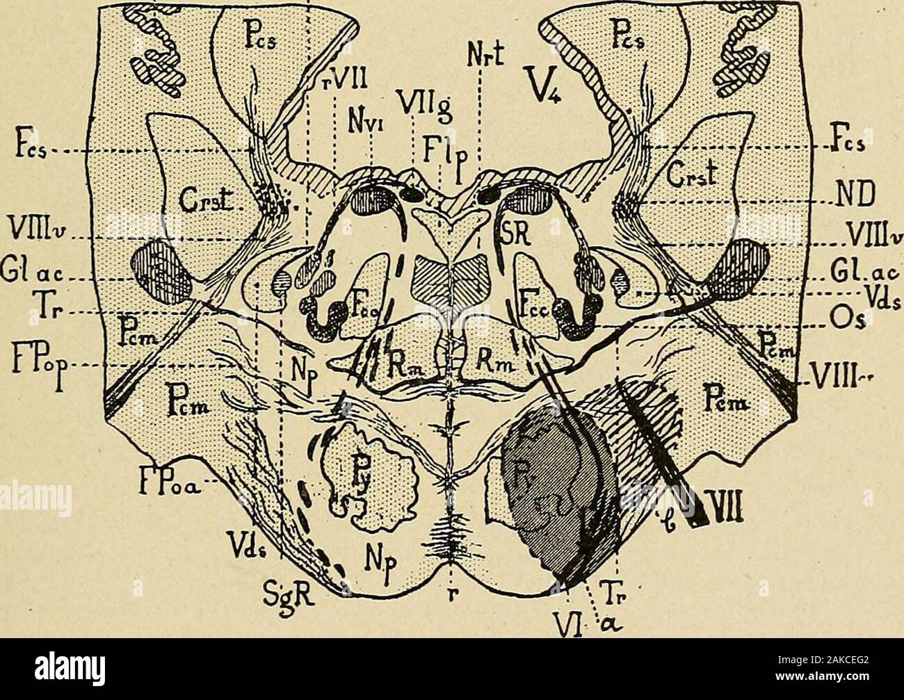 Les maladies du système nerveux : un texte-livre de neurologie et psychiatrie . O.e. Fig. 201.-antérieure syndrome de pontine. Paralysie secondaire inférieure-Millard-Gubler type. L'hémiplégie contralatérale du tronc et des extrémités du ponto-meduUary (type sans paralysie faciale inférieure) sans hemianesthesia withoutthe, et syndromes de Foville, avec paralysie secondaire peut être de la sixième seul nerf (un)ou de la sixième et septième (a et b). À ce niveau la cortico-nuoleo haveleft-fibres faciales la voie pyramidale avec le meduUopontine fibres aberrantes (voir planche II) andare dans l'otorhinolaryngologie désignant Banque D'Images Les maladies du système nerveux : un texte-livre de neurologie et psychiatrie . O.e. Fig. 201.-antérieure syndrome de pontine. Paralysie secondaire inférieure-Millard-Gubler type. L'hémiplégie contralatérale du tronc et des extrémités du ponto-meduUary (type sans paralysie faciale inférieure) sans hemianesthesia withoutthe, et syndromes de Foville, avec paralysie secondaire peut être de la sixième seul nerf (un)ou de la sixième et septième (a et b). À ce niveau la cortico-nuoleo haveleft-fibres faciales la voie pyramidale avec le meduUopontine fibres aberrantes (voir planche II) andare dans l'otorhinolaryngologie désignant Banque D'Images