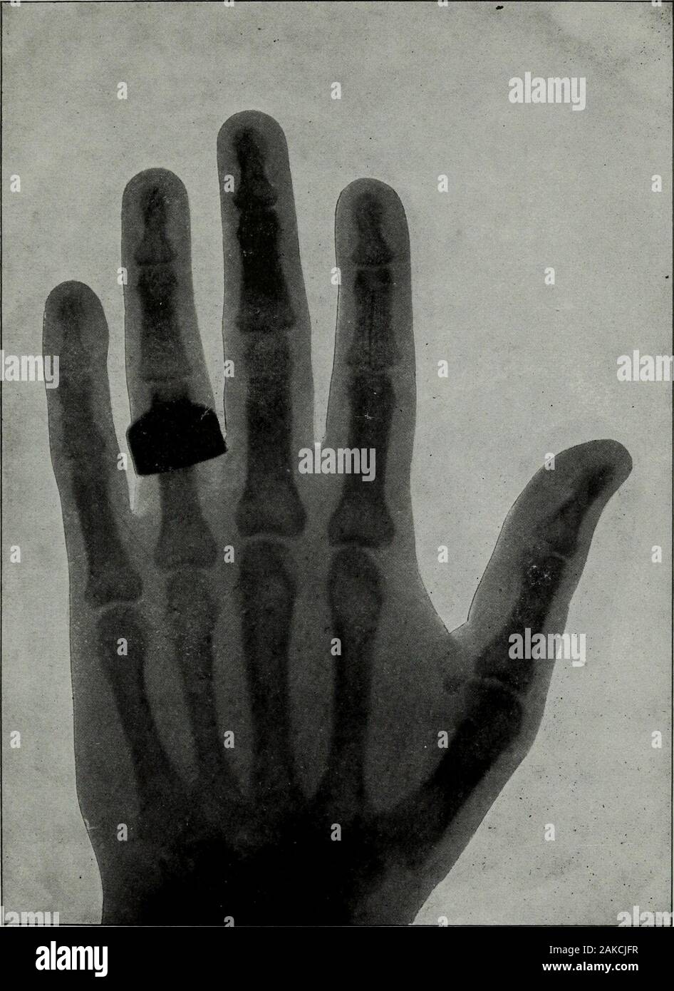 La science de la chiromancie Perin ; un traité complet et authentique . La part du président Roosevelt 243. La main de Thomas A. Edison, prises par les rayons X. 245 LA PART DE L'AMIRAL GEORGE DEWEY Banque D'Images