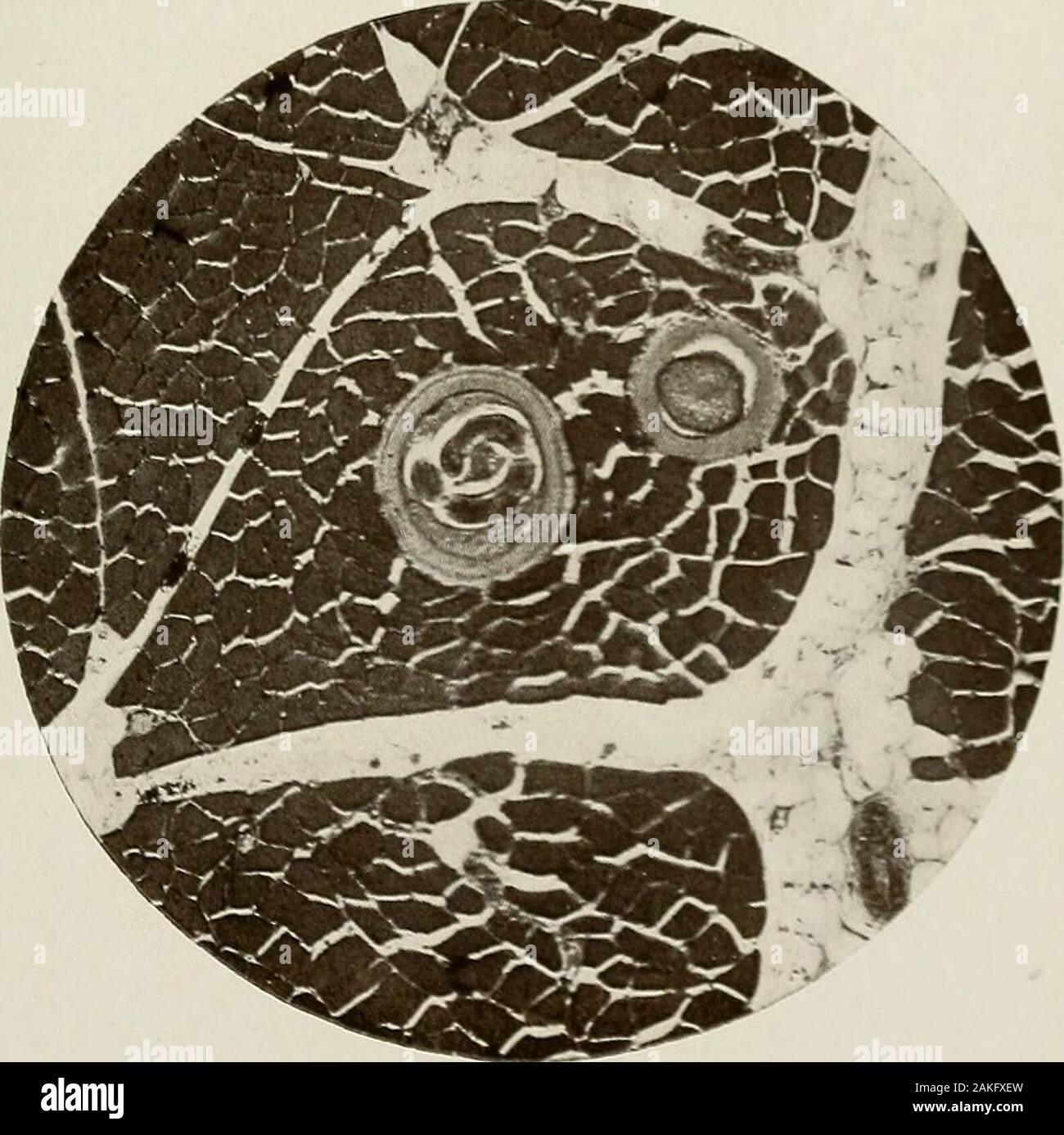 Un manuel pratique de l'hygiène pour les étudiants, les médecins, agents de santé et . ^."*, "j'ai de la trichine.  :&Lt ; 38.. Dans Trichinse Muscle de porc. X 75. JARASJJKJ MJJAT ET DE POISSON ET LA MALADIE. 41 j)ickl&Lt ;^&lt;l, en conserve, ou ni;j&lt;l( ! Dans Hmokcd HJinHn^cs, l'Oxer 40 [x-r wtnt.I.Ik ! (,Ii,S(s w( !r( ! &Lt;t;hu !(1 f,o IOiin)|)( !dans nic-il wliicli Ijfcn hhfr luid [embrassé(( ! À partir de &lt;rl&Lt ;,liina ;,;i.n(l lOiiropciin fiicit wliieli stic lo |j'lieerifoiMid contiiin;id 1.0 Le puni.ctci !, hut avait, nevcitlKtlcHM liandhj heen,"de l'iHt). S. I)e|)artmcnt nicMiHun^d'un ; en U ,ir/.) &Lt ;,f 2,227,710^ ho Banque D'Images