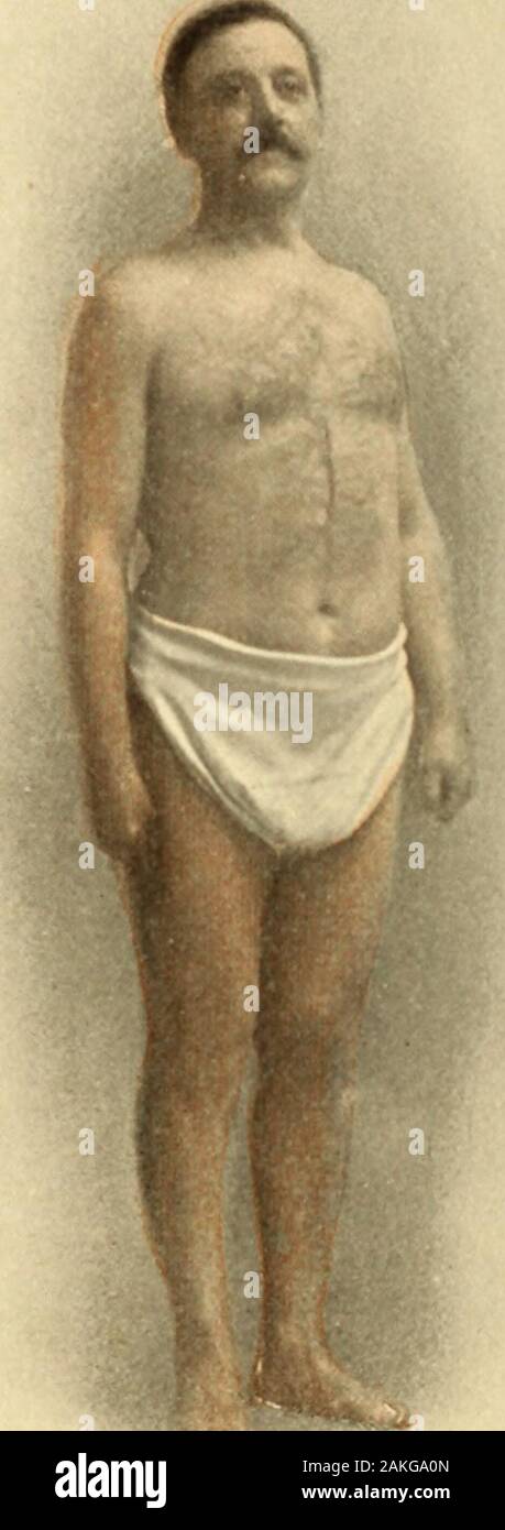 La culture physique . Samuel J. Miller, New York City, étudiant,J'ai 8 ans d'âge. La figure bon, général en matière de développement indique que l'immaturité, mais physiqueis incontestablement bien au-dessus de la moyenne et de symétrie. instrength qui ont demandé de poser pour ces spécimens misérable articleswere. Quelques werenot loin de ce que j'physicalwrecks à long terme, mais les jeunes hommes ont été forte, et robuste, et ont été dans presque tous les en position de spécimens d'physicalvigor fine en fait. J'avais proposé de prendre la photo-graphes plus à l'origine aux fins de l'ofshowing menwhom les défauts physiques de l'on pourrait choisir dans ce ca Banque D'Images