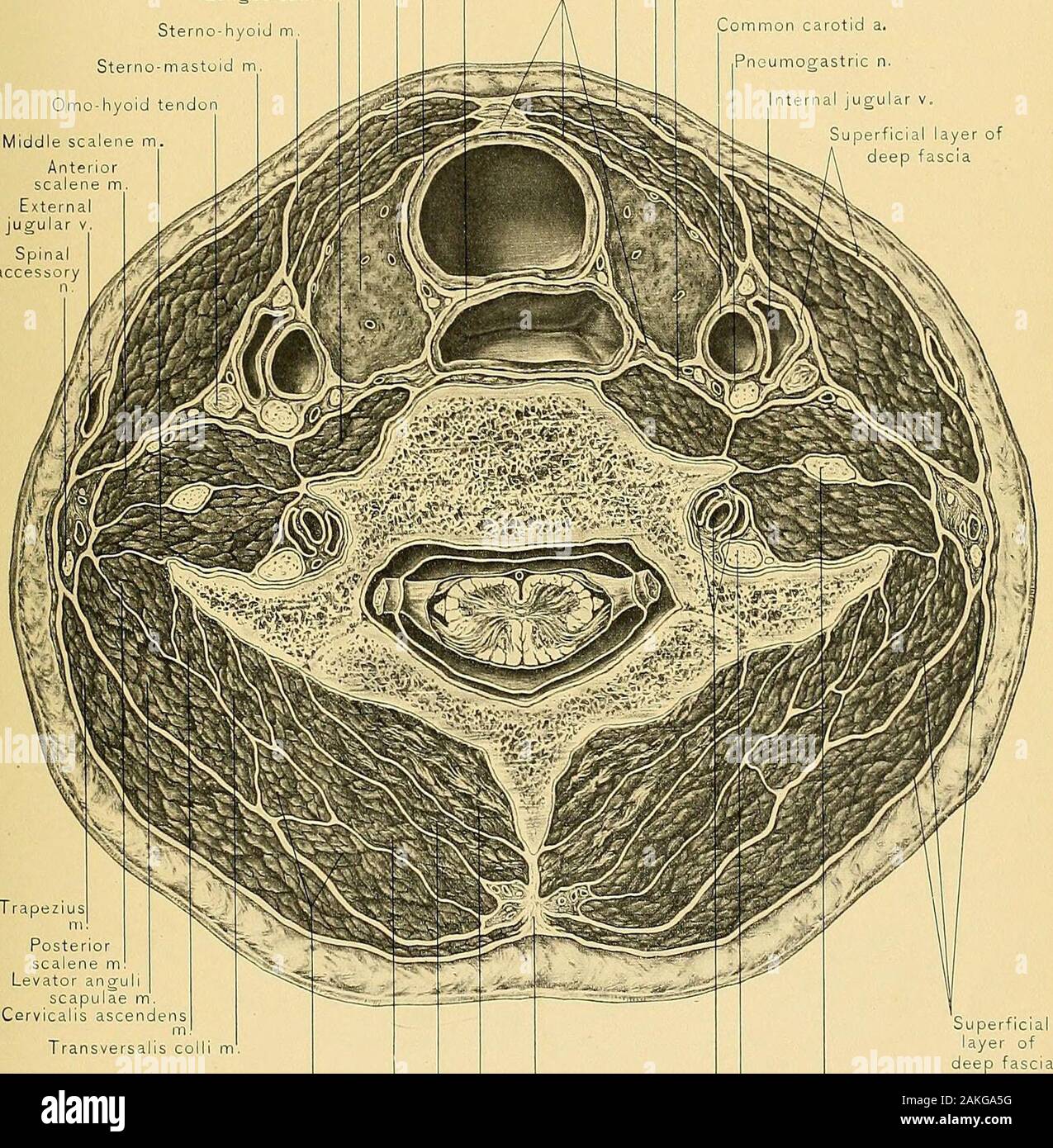 Anatomie chirurgicale : un traité sur l'anatomie humaine dans son  application à la pratique de la médecine et de la chirurgie des nerfs vical  .. Ici il perce thesuperficial couche du fascia