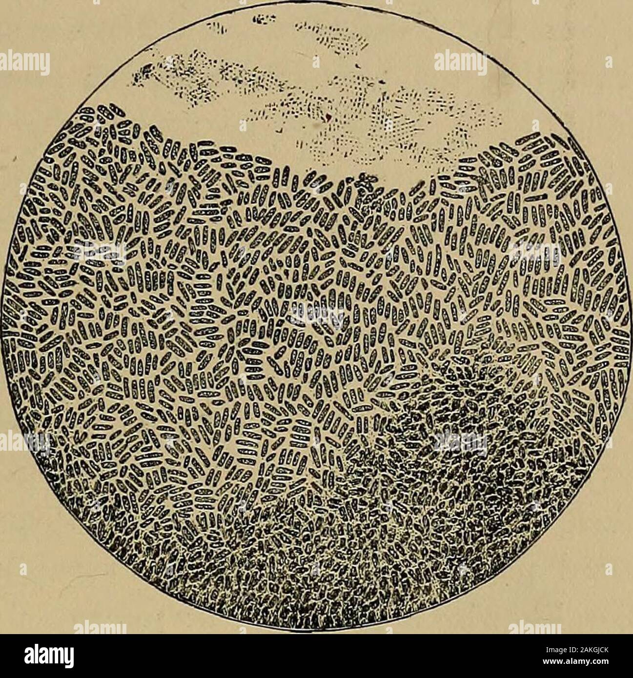 La fièvre typhoïde et la fièvre exanthématique . ded extrémités, environ trois fois aussi longtemps qu'ilssont large, et en longueur absolue d'un tiers du diamètre d'un sang rouge-corpuscule. Dans Peyers ulcérée correctifs et dans d'autres parties à la hauteurde la lésions spécifiques les bacilles formulaire, par application d'oneanother longitudinale, structures filamenteuses, d'abord décrite par Gaff ky comme pseudo-filaments. Dans diverses circonstances les bacilles subissent des modifications d'informer, de la taille, et l'arrangement. Ainsi, les filaments pseudo-alreadymentioned sera trouvé dans de vieux bouillon-cultures ou de gélatine-cultures,ainsi que sur l'acide de la pomme de terre de réagir Banque D'Images