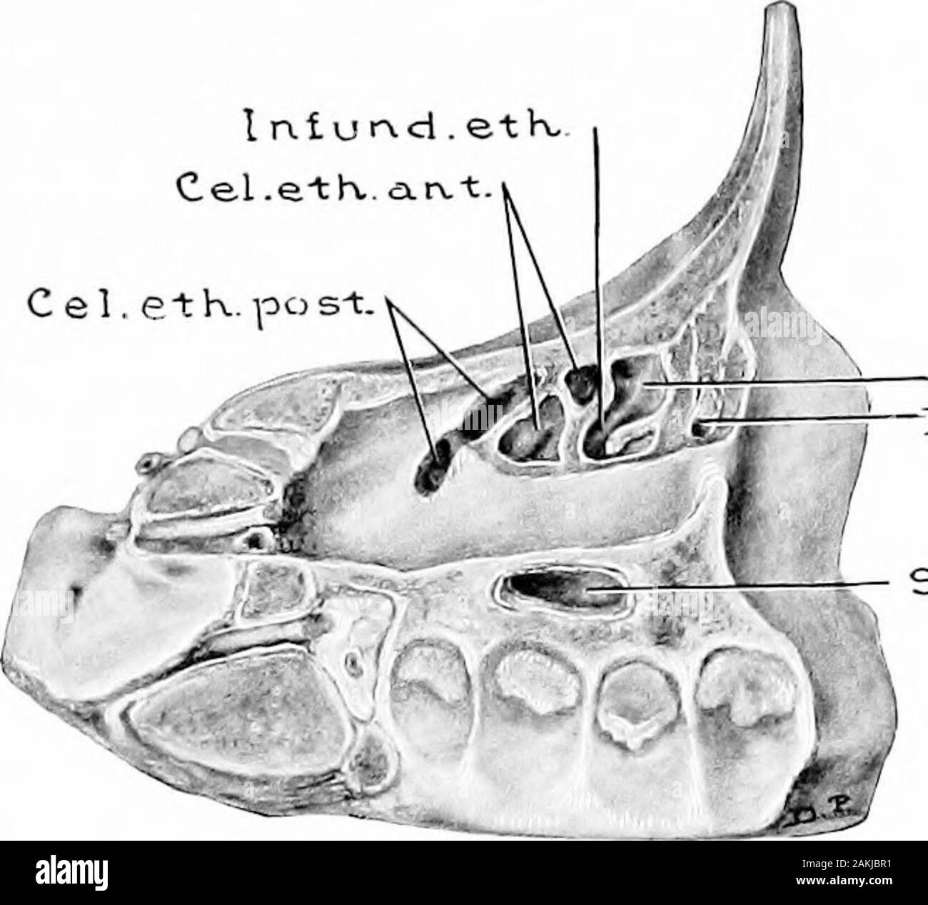 Le développement et l'anatomie de l'accessoire nasal sinus dans l'homme ; des observations sur la base de deux cent quatre-vingt-dix, les murs nasale latérale montrant les différentes étapes et types de développement de l'accessoire zones sinus à partir du soixantième jour de la vie fœtale à la maturité avancée . Le dans-fundibulum ethmoidale (Fig. 35), dans la classe de cas therewere antérieure et latérale des cellules à l'ostium. Le adultcellulse infundibulares sont généralement bordés par l'os frontal, supérieurement et souvent l'extension latérale est de manièreà ce genre s'étendent bien au-dessus de la plaque d'orbitales. En conséquence-infre pas de spécimens adultes Banque D'Images