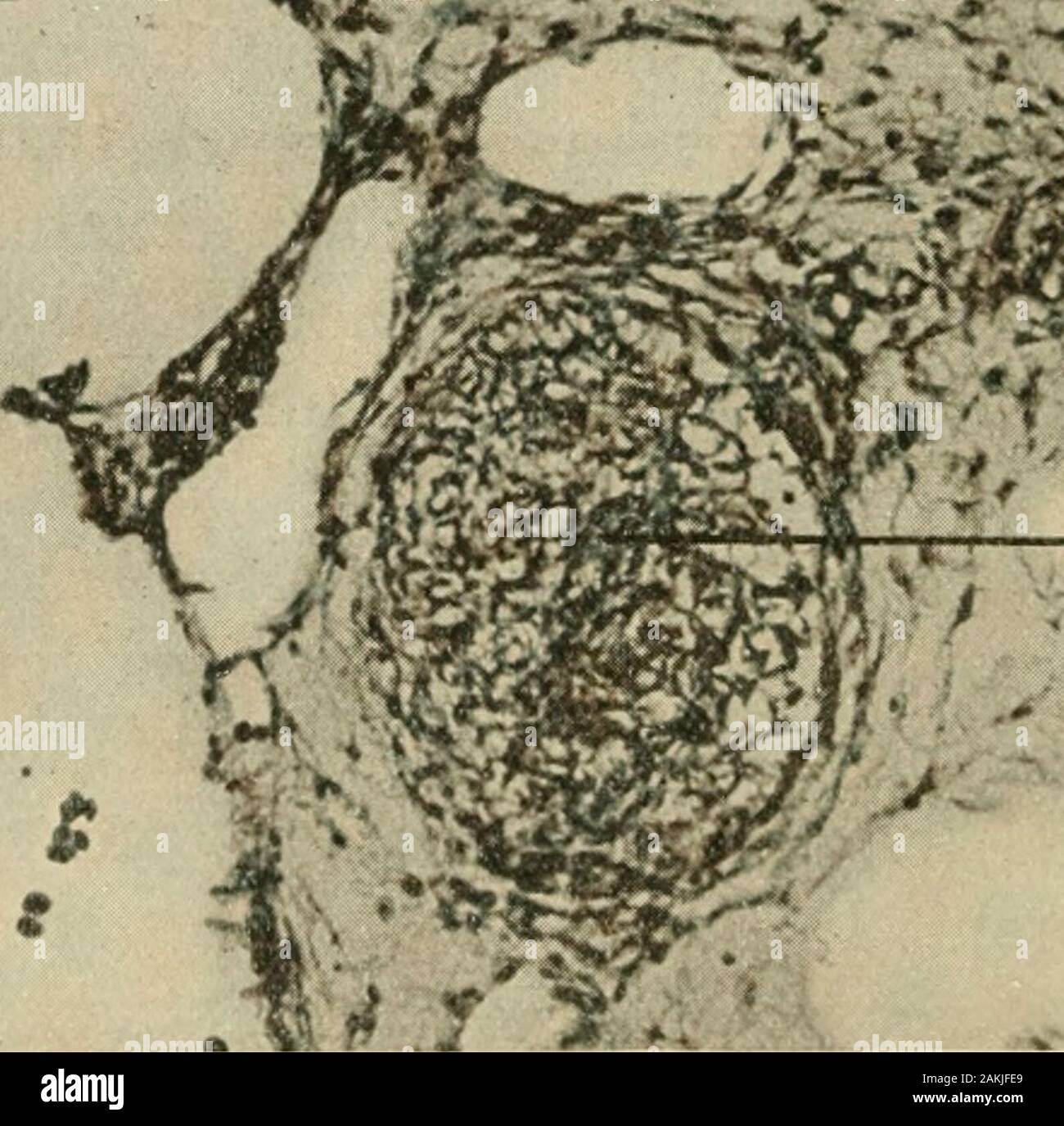 Le journal américain de l'anatomie comparée . &Gt;je T 9H Fig. 10 à partir d'une photographie d'une section transversale à travers l'embryon de poulet d'une wallonne de thoracique de huit jours et quatorze heures. / Precardinal ; 5, veine, jugularlymph-sac avec robinet, à 5a, sur l'orthèse dorso-mésial de la veine ; 7 precardinal,oesophage ; 9b, nerf vague ; 17, cavité pleurale. des embryons de montrer qu'il se développe dans le formulaire d'accord exacte-ment avec les mammahan stades ontogéniques.Il est donc probable que l'examen attentif de l'anteriorlymphatico- connexions veineuses de l'oiseau ne demonstratethe adultes persistance o Banque D'Images