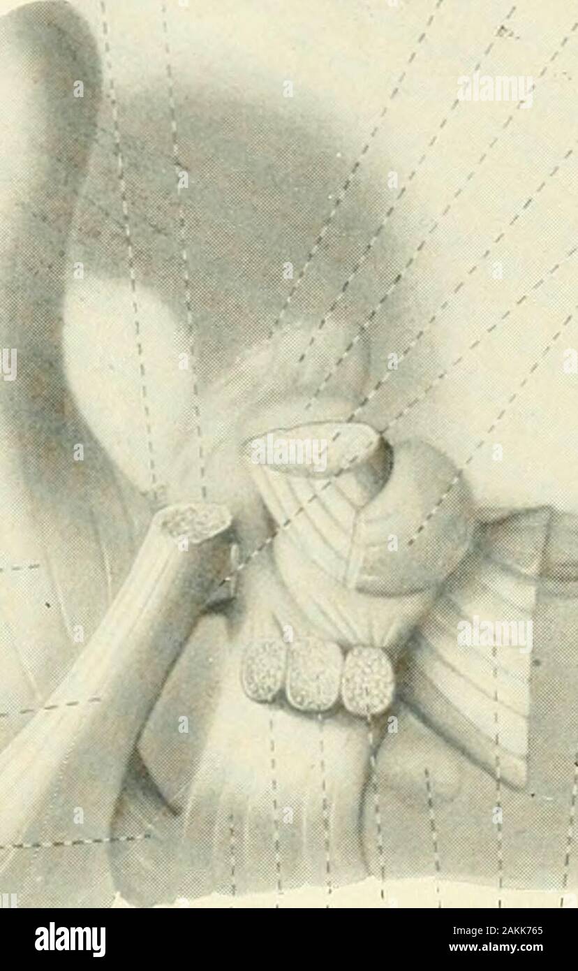 L'American journal of anatomy . isen III. Jenaische Denkschrift, 6. 436 JOHN H. STOKES Fig. 1 aspect latéral gauche d'une plaque de cire de la reconstruction des systèmes d'andvestibular cochléaires de l'opossum cerveau. 5 diamètres élargie. Le corpusrestiforme, le pont, les conjunctivum brachium et le septième areincluded nerveuses comme points de repère. Un decussating, fibres vestibulaires du noyau fastigiiand le nucleo-voies cérébelleuses ; B, nucleo-voies cérébelleuses. Fig. 2 aspect postérieur de la reconstruction de la fig. 1. Un noyau de la surface de coupe, fastigii. B, les fibres en passant de la fin supérieure de la nu Banque D'Images L'American journal of anatomy . isen III. Jenaische Denkschrift, 6. 436 JOHN H. STOKES Fig. 1 aspect latéral gauche d'une plaque de cire de la reconstruction des systèmes d'andvestibular cochléaires de l'opossum cerveau. 5 diamètres élargie. Le corpusrestiforme, le pont, les conjunctivum brachium et le septième areincluded nerveuses comme points de repère. Un decussating, fibres vestibulaires du noyau fastigiiand le nucleo-voies cérébelleuses ; B, nucleo-voies cérébelleuses. Fig. 2 aspect postérieur de la reconstruction de la fig. 1. Un noyau de la surface de coupe, fastigii. B, les fibres en passant de la fin supérieure de la nu Banque D'Images