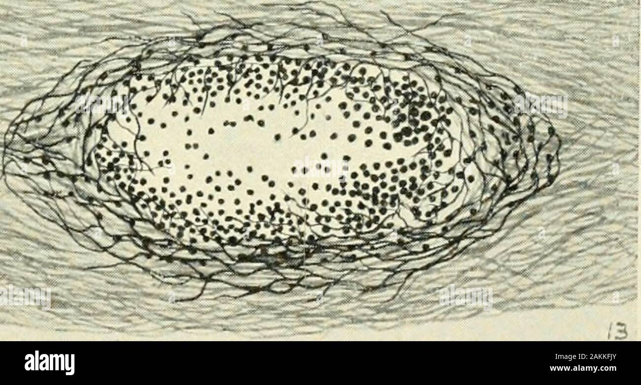 L'American journal of anatomy . Il n'est pas mince et d'autres tissus conjonctifs réticulaires laj 295^collaginous- er de tissus sur lesquels ils s'appuient. Il serait donc apparaître que la membrane de sous-sol des glandes sudoripares, contrairement à la plupart des autres membranes de sous-sol, ne contient pas reticulumbut collaginous est formé par fibres ensemble avec les cellules-peculiarbasket fibroglia, qu'ils soient ou de muscle. Si l'on compare à la même façon le lymj^hoicl endoplasmique de tissus on arrive à similarconclusions quant à la non-identité des endoplasmique (à savoir celles fiberswhich noircir avec la méthode Bielschowsky) et il fibroglia.w Banque D'Images