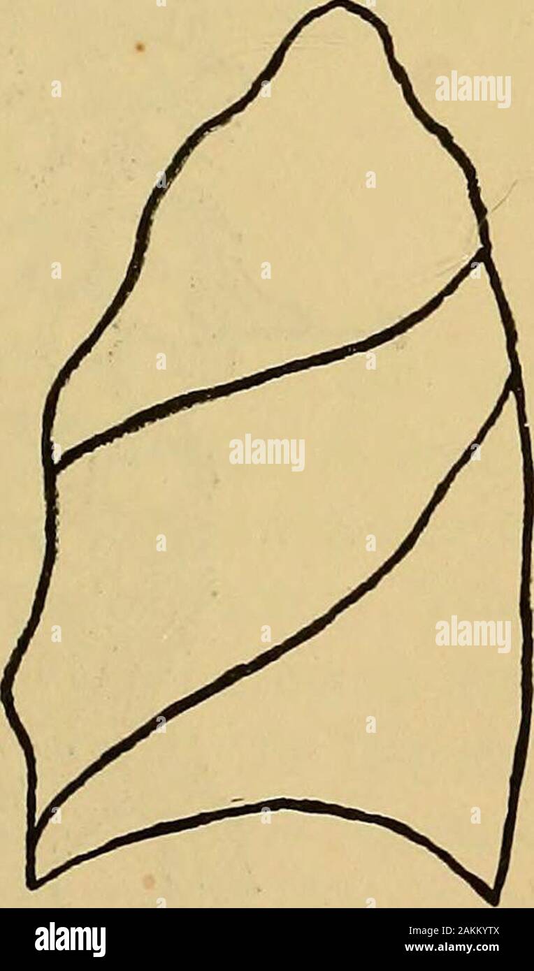 La consommation pulmonaire, pneumonie, et des maladies des poumons : l'étiologie, la pathologie et le traitement, avec un chapitre sur le diagnostic physique . Fig. II.-poumon gauche. Vue de côté. Fig. 12.-poumon droit. Vue de côté. pendages. Dans les murs de la trachée et des bronches tubesring les cartilages en forme de développer, qui maintiennent ces structuresdistended. Les poumons, comme tous les autres organes, de posséder un cadre tosupport constituant leurs structures. Il se compose d'thepleura, le et interlobulaires interlobaires et intra-alveolarsepta, et de ces sont suspendus les bronches, aircells, nerfs, vaisseaux sanguins Banque D'Images
