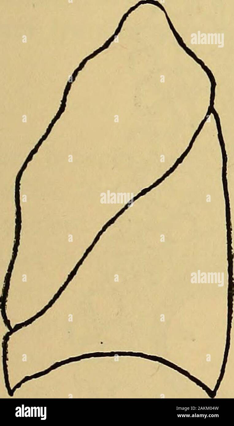 La consommation pulmonaire, pneumonie, et des maladies des poumons : l'étiologie, la pathologie et le traitement, avec un chapitre sur le diagnostic physique . ar comme la quatrième côte, et le middlelobe s'étend d'ici jusqu'à la base de la poitrine, une petite onlyallowing point du lobe inférieur à apparaître à l'arrière.latéralement les lobes inférieurs absorber presque tout le surfaceon les deux parties s'étendant à la troisième forme d'thebase épine dorsale de la poitrine. Les lobes supérieurs combler l'espace au-dessus de PATHOLOGIE DE LA CONSOMMATION pulmonaire. 249 la troisième épine dorsale, et le lobe central du droit lungis tout juste visible à Banque D'Images