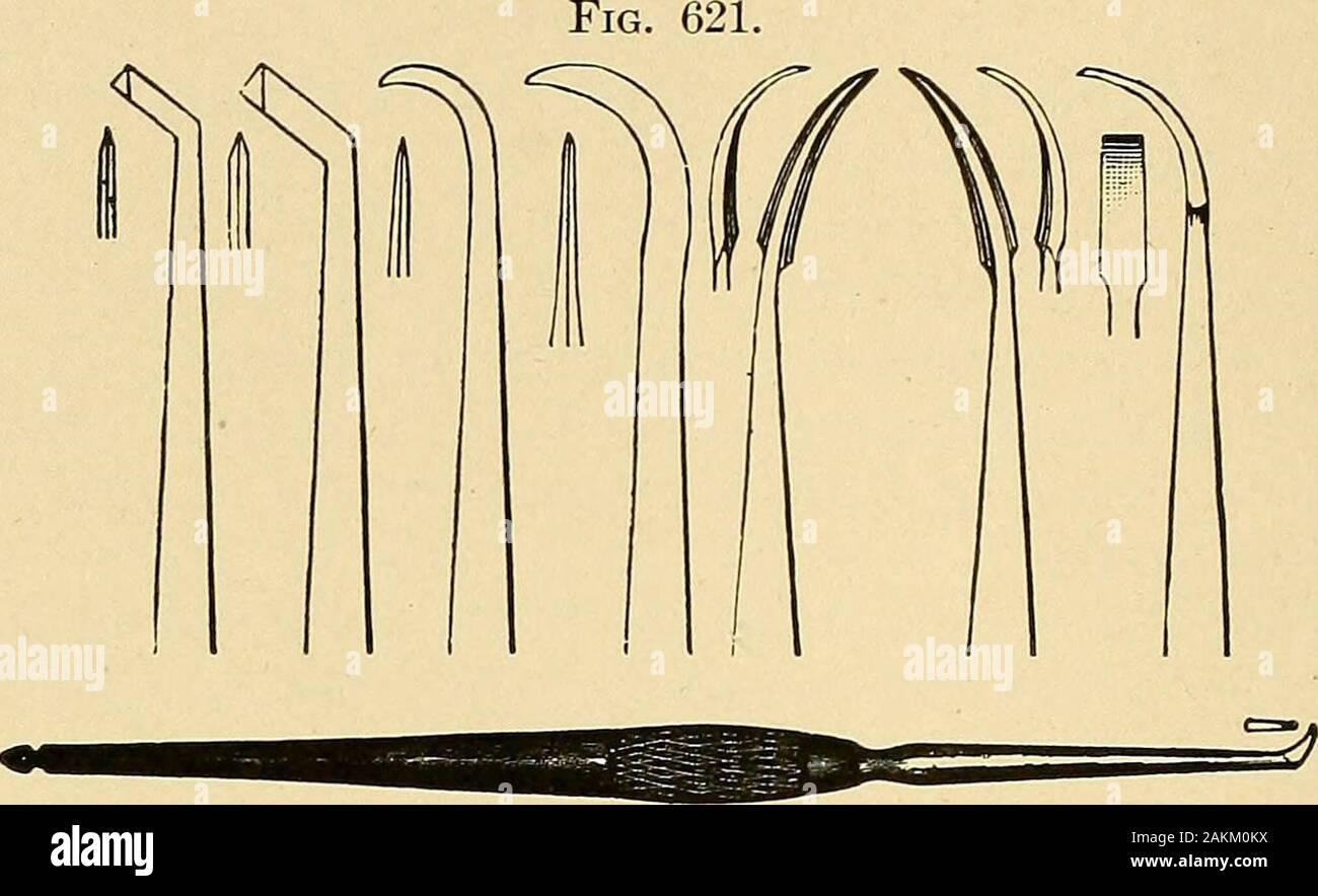 Principes et pratique de la dentisterie opératoire . nder d'autres circonstances, d'où son accumulation plus rapide de l'accu. La troisième variété, ou est-sous-gingivale, ce qui est trouvé dans thinscales sur les côtés de la racine des dents dans une poche ouverte plus lessremote ou à partir de la marge libre de la gencive. Cette forme de dépôt et itseffect pericementum sur le et les tissus environnants s'affiche discutée dans le chapitre sur le pyorrhoea alveolaris. Le traitement.-Le traitement de l'supergingival ordinaryform les dépôts, ou de calculs salivaires, et de la variété du col consiste en removingthe concreti Banque D'Images