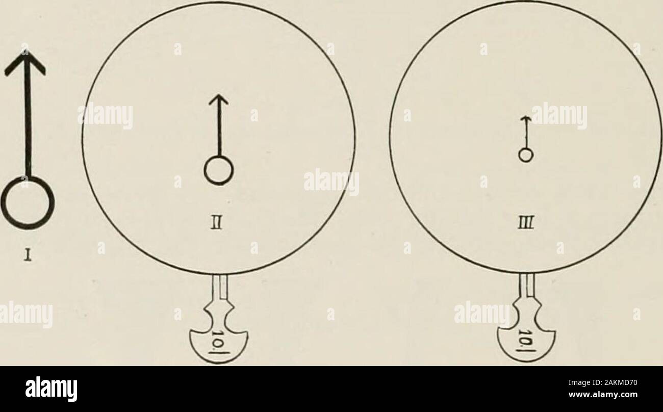 La réfraction oculaire et l'ombre test . oncavescopic ; C et D, bi-iicave, ménisque concave lentilles sphériques, ils sont qualifiés d'^concaii pluinal lentilles. Itwill être vu que les rayons parallèles dans palssing R par l'concavelens L sont réfractés en rayons divergents R et peuvent donc nevermeet, afin qu'ils ne sont pas portés à l'attention. Une lentille concave donc n'a pas vraiment fccus mais seulement une inrtiial l'accent qui est situé par l'ex- tendant les rayons divergents jusqu'à un point où ils se rencontreraient,comme P Figure 54. Différents types de lentilles sphériques concaves sont illus-tré par la figure 55 ; A est un plano-batteur Banque D'Images
