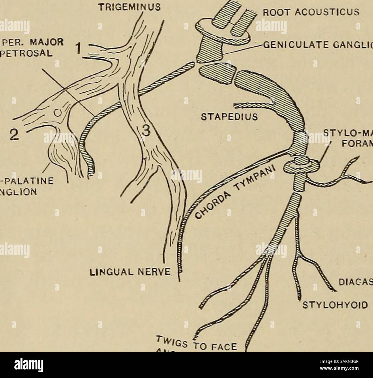 Un traité sur les principes et la pratique de la médecine . ve l'atrophie musculaire aiguë ou poliencephalitis rarelyinvade la septième noyau. 884 les maladies des nerfs crâniens 6. Des facteurs plus rares sont l'hémorragie dans les trompes, la maladie du canal ou glandes lymphatiques parotides et infiltration leucémique. La pathologie.-peu d'autopsies ont été faites. Le nerf a été foundsevered, son fourreau et axis-cylindres, détruit les noyaux dans Schwannssheath ont augmenté, l'augmentation du tissu conjonctif et les muscles lavis d'acides. L'essentiel et d'habitude le changement est dans l'exsudation perineuritis,com gaine Banque D'Images Un traité sur les principes et la pratique de la médecine . ve l'atrophie musculaire aiguë ou poliencephalitis rarelyinvade la septième noyau. 884 les maladies des nerfs crâniens 6. Des facteurs plus rares sont l'hémorragie dans les trompes, la maladie du canal ou glandes lymphatiques parotides et infiltration leucémique. La pathologie.-peu d'autopsies ont été faites. Le nerf a été foundsevered, son fourreau et axis-cylindres, détruit les noyaux dans Schwannssheath ont augmenté, l'augmentation du tissu conjonctif et les muscles lavis d'acides. L'essentiel et d'habitude le changement est dans l'exsudation perineuritis,com gaine Banque D'Images
