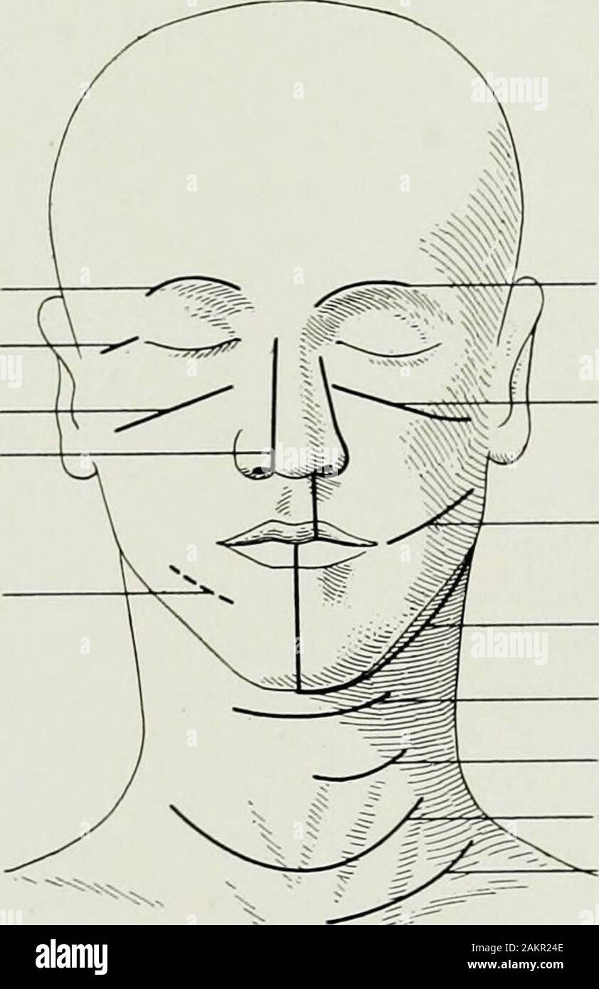 La chirurgie de guerre du faceA traité sur la restauration en plastique après blessure au visage par Jean BRoberts ..préparé à la suggestion du paragraphe sur le plastique et la chirurgie buccale connecté avec le bureau du chirurgien en generalIllustrated avec 256 abscessOccipital arteryLateral 1046 chiffres . pharyngotomyPrevertebral abscessExternal tongueExcision l'excision de l'artère carotide du nerf accessoire Spinal mandibule ensemble et provoquer de très peu de cicatrices. Cicatrices reçues en enfant-capot augmentait proportionnellement avec la croissance du patient.Cette circonstance peut causer des cicatrices qui semblent insignificantin childho Banque D'Images