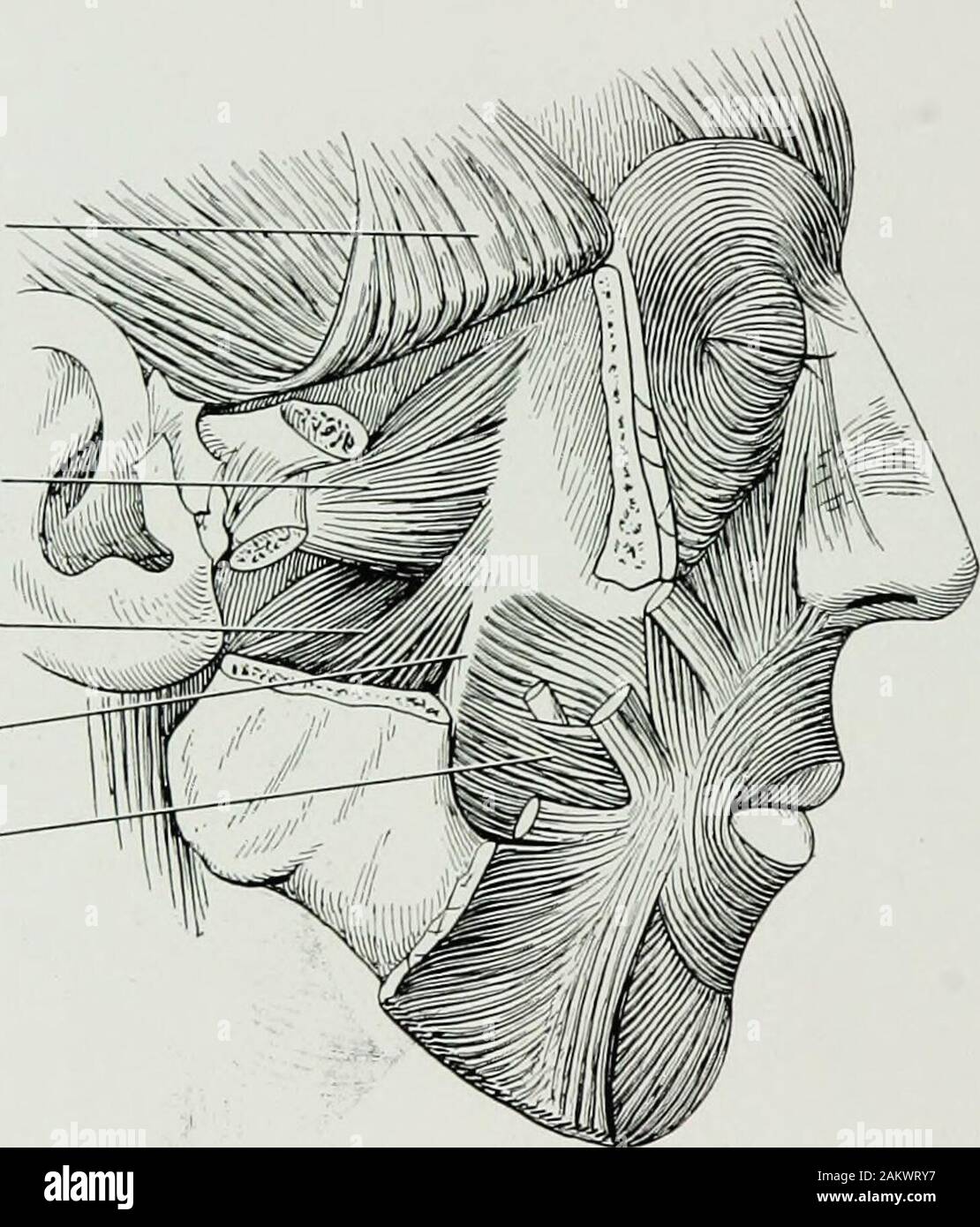 La chirurgie de guerre du faceA traité sur la restauration en plastique après blessure au visage par Jean BRoberts ..préparé à la suggestion du paragraphe sur le plastique et la chirurgie buccale connecté avec le bureau du chirurgien en generalIllustrated avec 256 chiffres . Cunningham.) et sous le lobe de l'oreille devrait se rappeler. Immédiatement après la marge postérieure de la branche montante de la mâchoire inférieure est l'artère carotide externe, une structure pour becarefully évités lors de l'utilisation entre l'oreille et la mâchoire. L'artère temporale, qui est l'une des branches terminales de la carotide externe, s'étendent vers le haut Banque D'Images