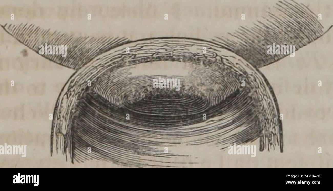 Physiologie humaine (Volume 2) . f le coeur de l'fetusare audible. Cette instrumentmay aussi la pièce quand la grossesse est multiple, par l'indication d'thepulsations de deux ou plusieurs cœurs distincts, selon que la concep-tion est double, triple, &c. Il semblerait, toutefois, que aus-cultation mais offre deux principaux signes de grossesse, - l'pulsa-tions du coeur du foetus, et un murmure, qui, selon, tosome devrait, à juste titre, être désigné le souffleor utérine murmure. Ce Murmure a été censé avoir lieu dans theuterine artère, qui sert à la nutrition du placenta, et un Banque D'Images