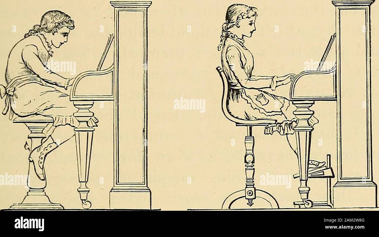 Le traitement de la déviation de la colonne vertébrale latérale : avec l'annexe donnant une analyse de 1000 cas traités consécutifs par la posture et l'exercice exclusivement, sans appui mécanique . Dans utile pour les repas (voir fig. 18, ce qui représente un goodmusic-tabouret, dos, également fabriqués par l'Angleterre Northof mobilier scolaire Co.). Dans tous les cas, la COURBURE LATÉRALE DE LA COLONNE VERTÉBRALE. 33 siège de la chaise ou la table doivent être horizontales, et nottilted jusqu'à l'avant, comme c'est souvent vu dans calledspinal divans ; et les patients pieds devraient toujours besupported, soit par le sol ou par un repose-pieds. Ial Banque D'Images