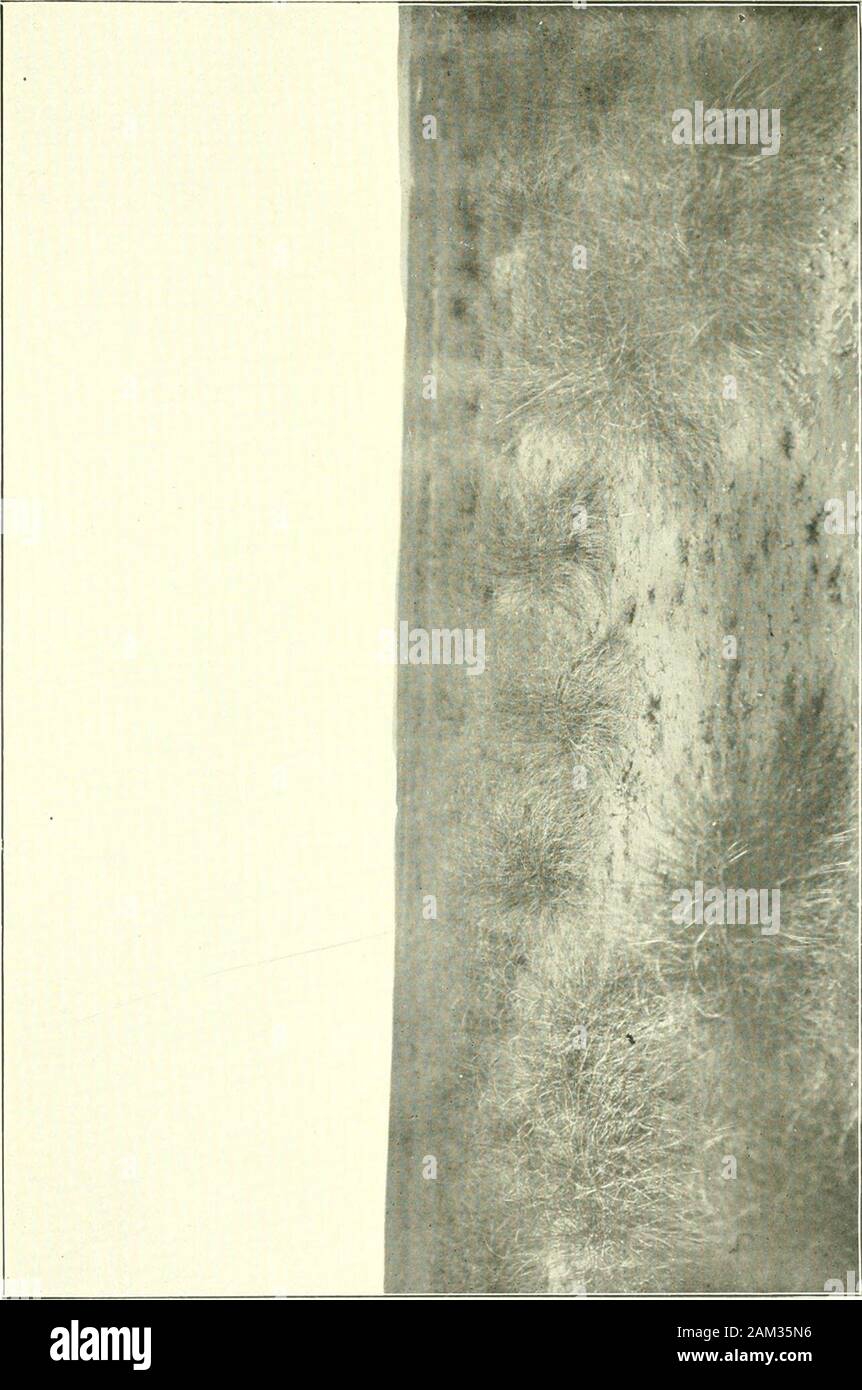 Etudes De Lepidopterologie Comparee 5 Ro C Li 1 T C C X V O Lt I H 1 U L R J Jj Cajrt Cj C 2 C S O F