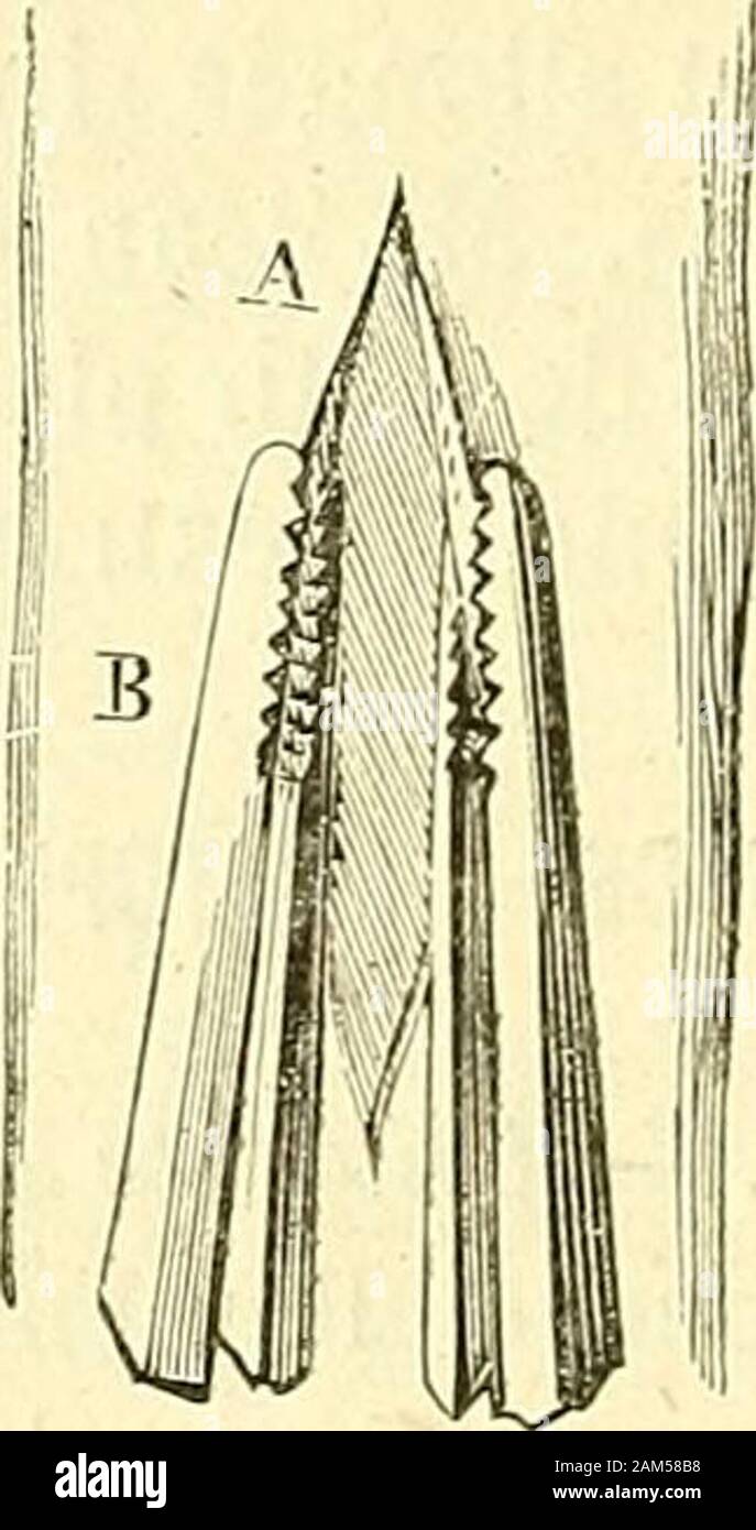 Chirurgie journalière des hôpitaux de Paris : répertoire de thérapeutique chirurgicale . irailler ce lambeau qui doit sappliquer rather par son propre poids. c. Épithélioma du front, des lèvres. - L'ablation, incisions libéra-trices. - Autoplastie par glissement. - Voici les règles par généralessuivies ce chirurgien : ablation de la tumeur par linstrumenttranchant, rapidité dexécution en rapport avec la grande quantitéde sang fournie par ces tissus très-vasculaires : jeu des pinces hé-mostatiques (voir plus haut), incisions libératrices des multiples, maisdont le nombre et la direction souvent suiva Banque D'Images