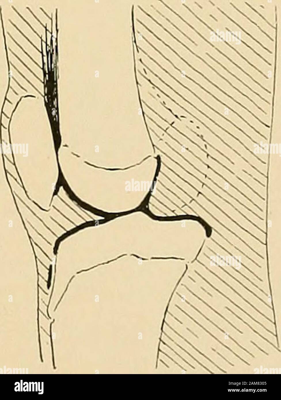 Le traitement des fractures . Fig. 569.-Rapport de la capsule d'theshoulder-joint pour l'épiphyse supérieure d'thehumerus (schéma).. Fig. 568.-l'épiphyse de l'humérus ateight jears (Warren Museum, modèle334)- Fig. 570.- Rapport de la capsule de theknee-joint pour la rotule, le fémur et le tibia(schéma). ance de l'Rontgen Ray un très grand progrès sont accomplis dans l'exactitude de notre connaissance de l'épiphyse. Alors que therewill, peut-être, il existe toujours des différences dans les périodes de l'apparaître de l'centres d'ossification et de l'époque de l'union de la 403 4O4 DES FAITS CONCERNANT LES EPIPHY anatomique Banque D'Images