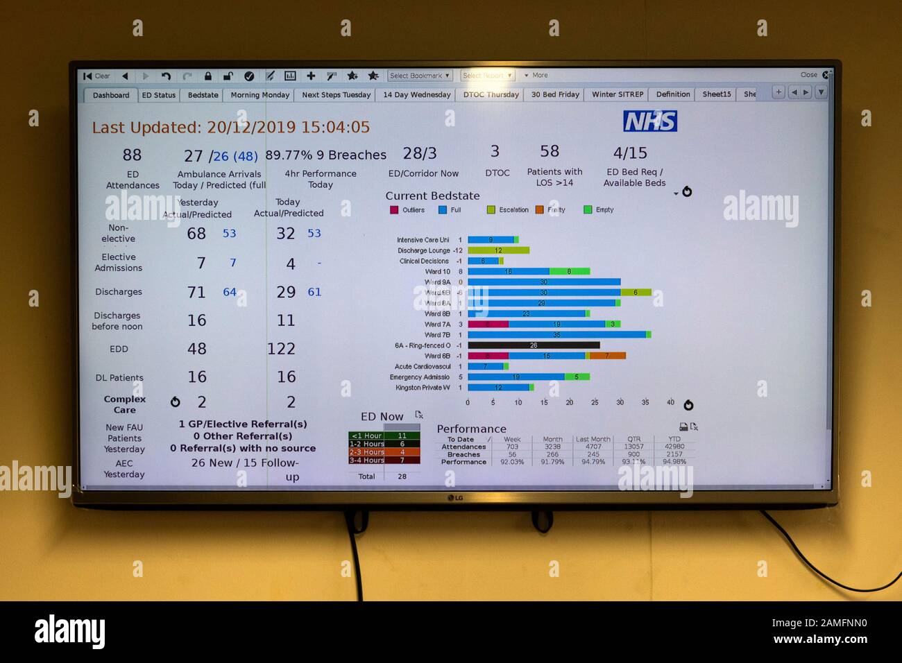 Hôpital du district de Yeovil, Somerset, montrant la carte d'état numérique Banque D'Images