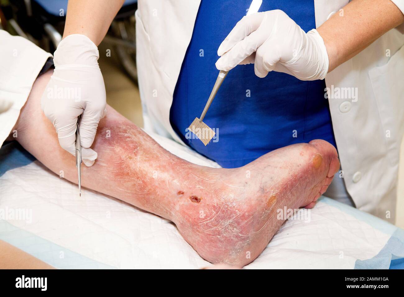 Les médecins de l'hôpital de troisième ordre de Menzinger Straße 44 à Munich appliquent le miel de Manuka comme agent thérapeutique aux blessures infectées dans les cas graves. Sur la photo, la « jambe ouverte » d'un nun âgé est patchée vers le haut. [traduction automatique] Banque D'Images