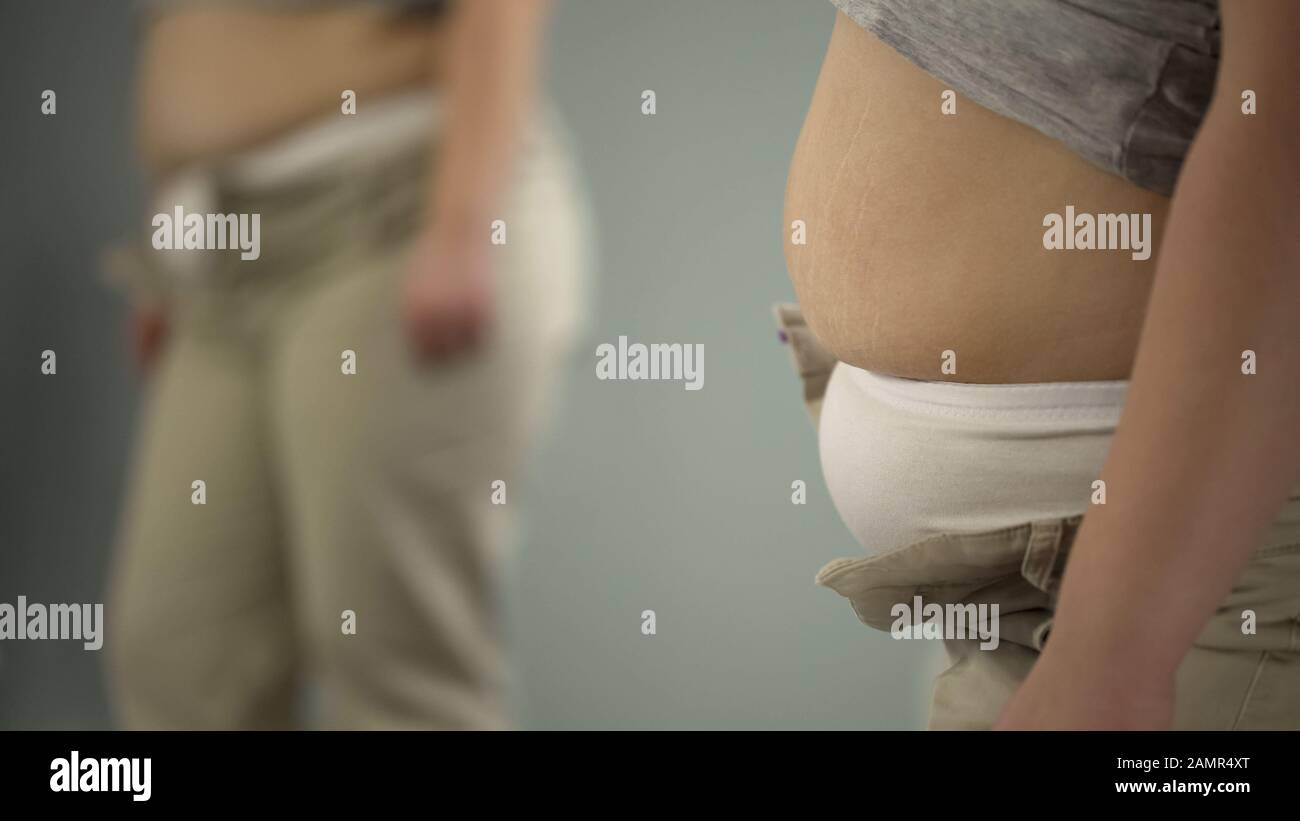 Gros ventre féminin avec des marques d'étirement, ne peut pas bouton  pantalon serré en raison de l'obésité Photo Stock - Alamy