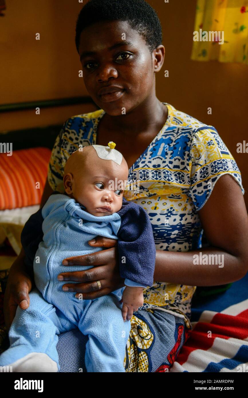 Rwanda, Butare, centre de santé Gikonko, mère avec enfant infecté par l'hydrocéphalie et exploité ici / RUANDA, Butare, Institut Saint Boniface, Krankenstation Gikonko, Mutter mit ihrem Kind, das mit der Krankheit Hydrozephalus operiert wurde, Frau Albertine und ihrem Kind Ella Banque D'Images