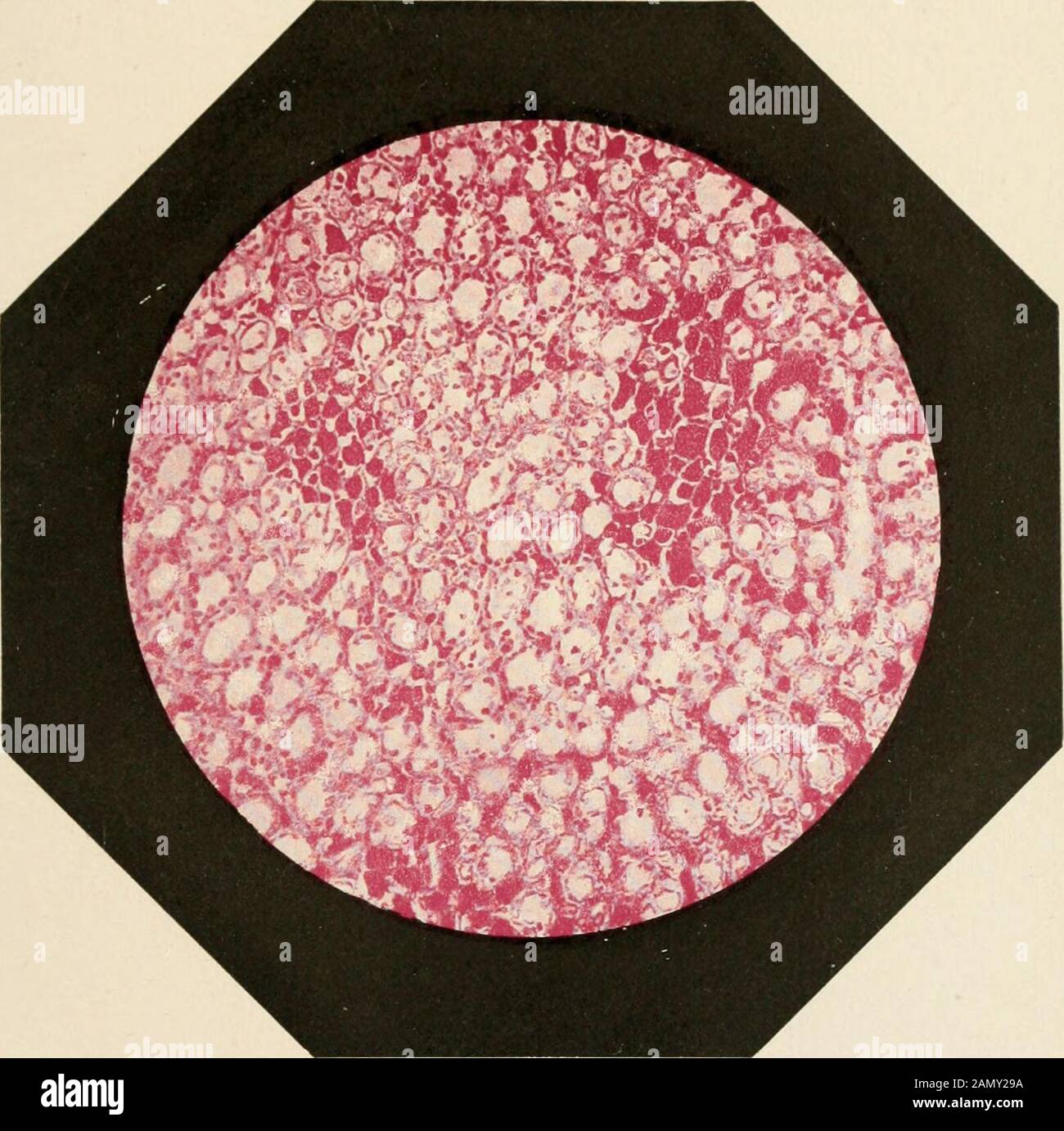 Atlas d'histologie normale : principaux tissus et organismes . *^Q *~Q i Atlas dHistologie normale. XLV Hanche. Topp. Et. Rabal-d.Microphot. F. Monpillard. Cirav. Et imp. Prieur Et Diboi?Puteaux. Georges CARRÉ et C. NAUD, Éditeurs PLANCHE XLYI planète XLVI VASCULARISATION DU RÉIN Grossisissement : 55 diamètres. Linjection pousée par lartière met en relief les artèrestabulaires {ya) qui fait don aux artères glomique-lares (ag), lesquelles sont les informations à leur tour au pe-lolon vaseulaire (gv) des règles de Malpighi. Irmnle XI. Banque D'Images