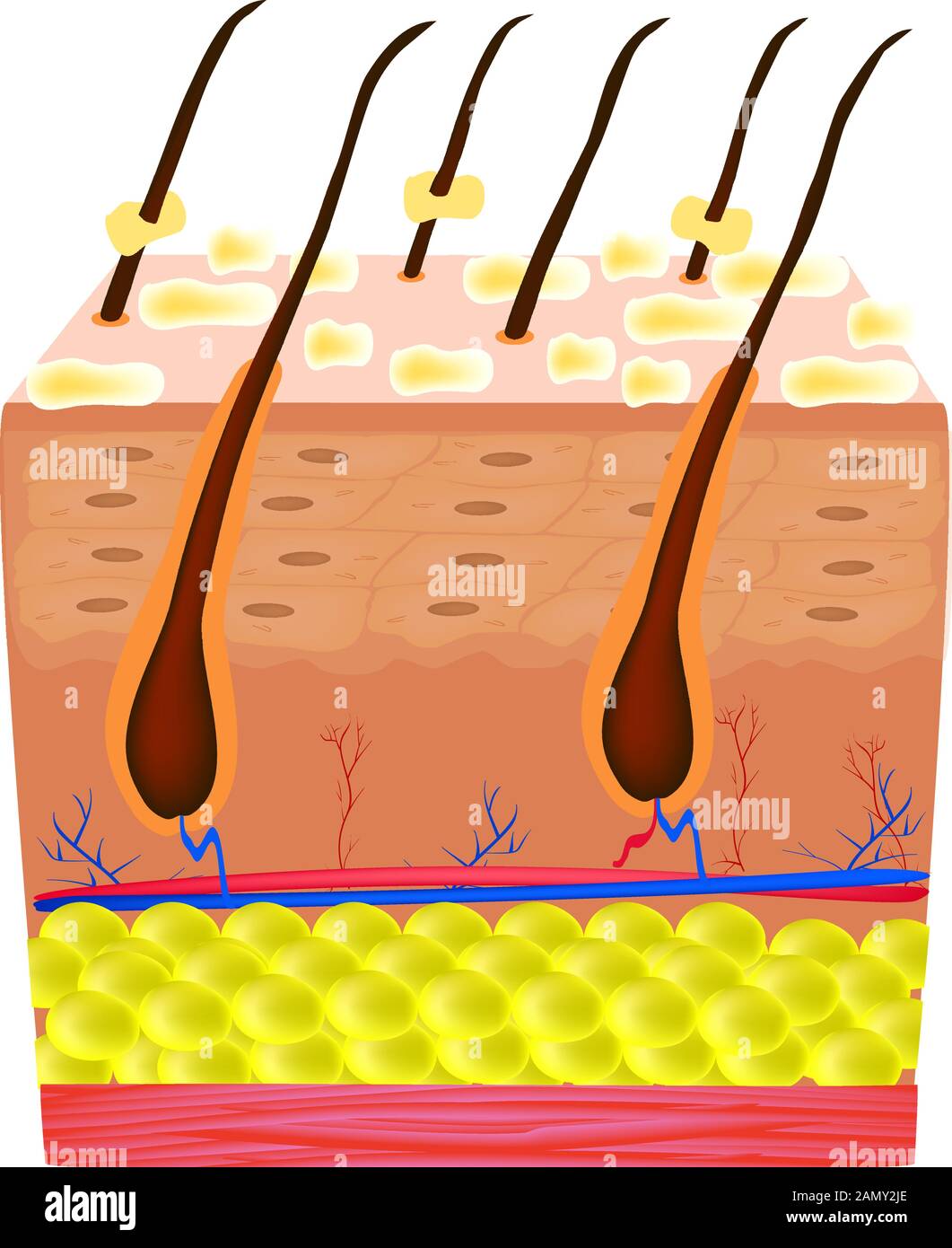 Peau et cheveux de séborrhée. Dermatite séborrhéique de pellicules. Dysfonctionnement des glandes sébacées. Maladie inflammatoire de la peau. Structure anatomique Illustration de Vecteur