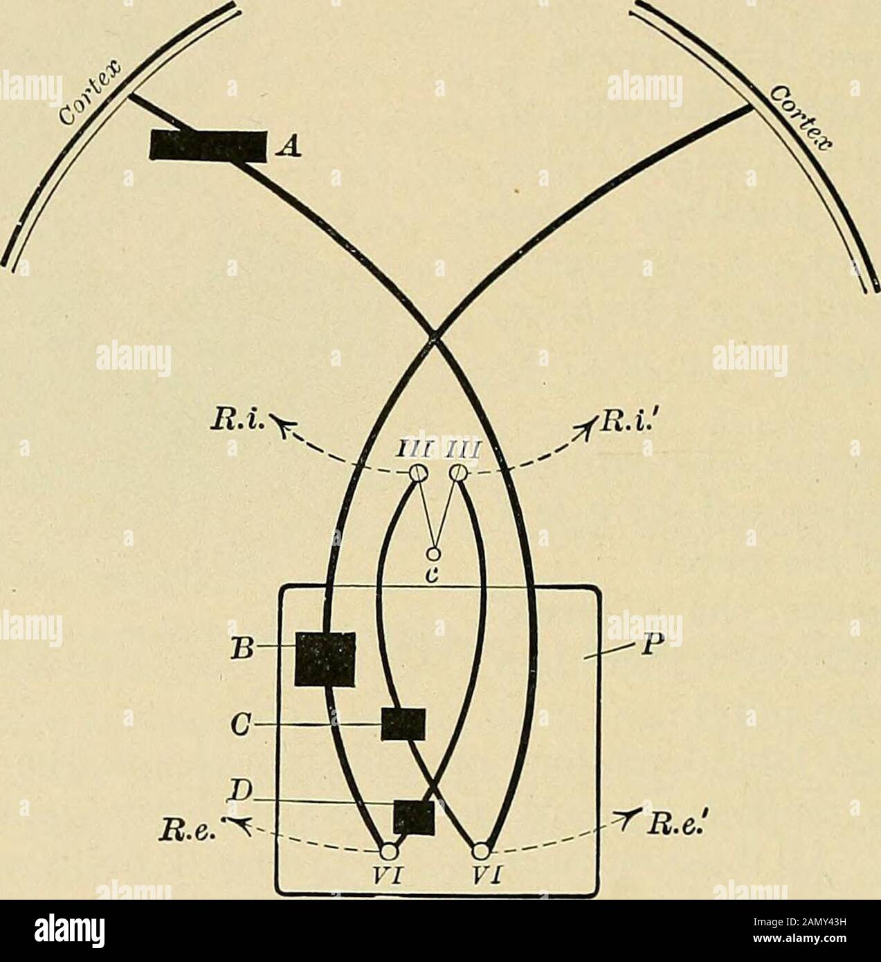 Maladies nerveuses organiques et fonctionnelles; un livre de texte de neurologie . Paralysie de la sixième, septième et huitième nervosité gauche d'une fracture à la base du crâne. 644 LES MALADIES CRÂNIENNES NEVES ET THEIB. Du mouvement latéral conj agate passe directement au sixième noyau nerveux, et c'est là qu'une impulsion est renvoyée au troisième nerf opposé par le passage du faisceau longitudinal postérieur. Fig. 273 montre ce tractus et démontre le fait que les lésions à différentes parties de celui-ci causent le mouvement conjuguée latéral de paralysisof des deux yeux. L'irritation des centres moteurs dans le cortex cause involontaire Banque D'Images Maladies nerveuses organiques et fonctionnelles; un livre de texte de neurologie . Paralysie de la sixième, septième et huitième nervosité gauche d'une fracture à la base du crâne. 644 LES MALADIES CRÂNIENNES NEVES ET THEIB. Du mouvement latéral conj agate passe directement au sixième noyau nerveux, et c'est là qu'une impulsion est renvoyée au troisième nerf opposé par le passage du faisceau longitudinal postérieur. Fig. 273 montre ce tractus et démontre le fait que les lésions à différentes parties de celui-ci causent le mouvement conjuguée latéral de paralysisof des deux yeux. L'irritation des centres moteurs dans le cortex cause involontaire Banque D'Images