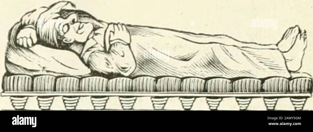 Saint Louis Medical and Surgical Journal . rofula, phthisis, cancers, caohexv syphilitique, rate élargie, et dans la chlorose où le fer seul lias a échoué. L'éachdose contient un grain chacun des Iodures de fer et de manganèse. Prix «1 .=50. Extrait amélioré de malt pour les tondeuses — avec AETERATIVES. —la dose de I^ach contient des pro]iortions appropriées de l'iodure de calcium et de fer, ainsi que des Chlo-rides et des Uromides de Jlagnesium, de sodium et de potassium. Cette combinaison d'alteratifs mostpuissants de l'ihe avec l'Ionics et les restauratifs a été employée avec succès dans les formes différentes de dépendance à la maladie Banque D'Images