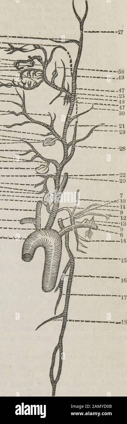 Le guide du dissecteur, ou, compagnon de l'étudiant : illustré par de nombreux boisés, montrant clairement et expliquant la dissection de chaque partie du corps humain . calcul, si l'artère tid caro- j*1™ étaient liée. 33-J— - 10. Les cervicalis ascendens. 3 i  11. Le transversalis colli. 5 12. L'supra-scapulaire. 13. Le cervicalis profundus. 14. L'artère intercostale supérieure, qui passe sur les théaches des côtes, et divise les intobranches, qui fournissent les trois espaces intercostales supérieurs. 15. L'artère mammaire interne, qui envoie 16. L'artère péricardique. 17. L'artéria co Banque D'Images