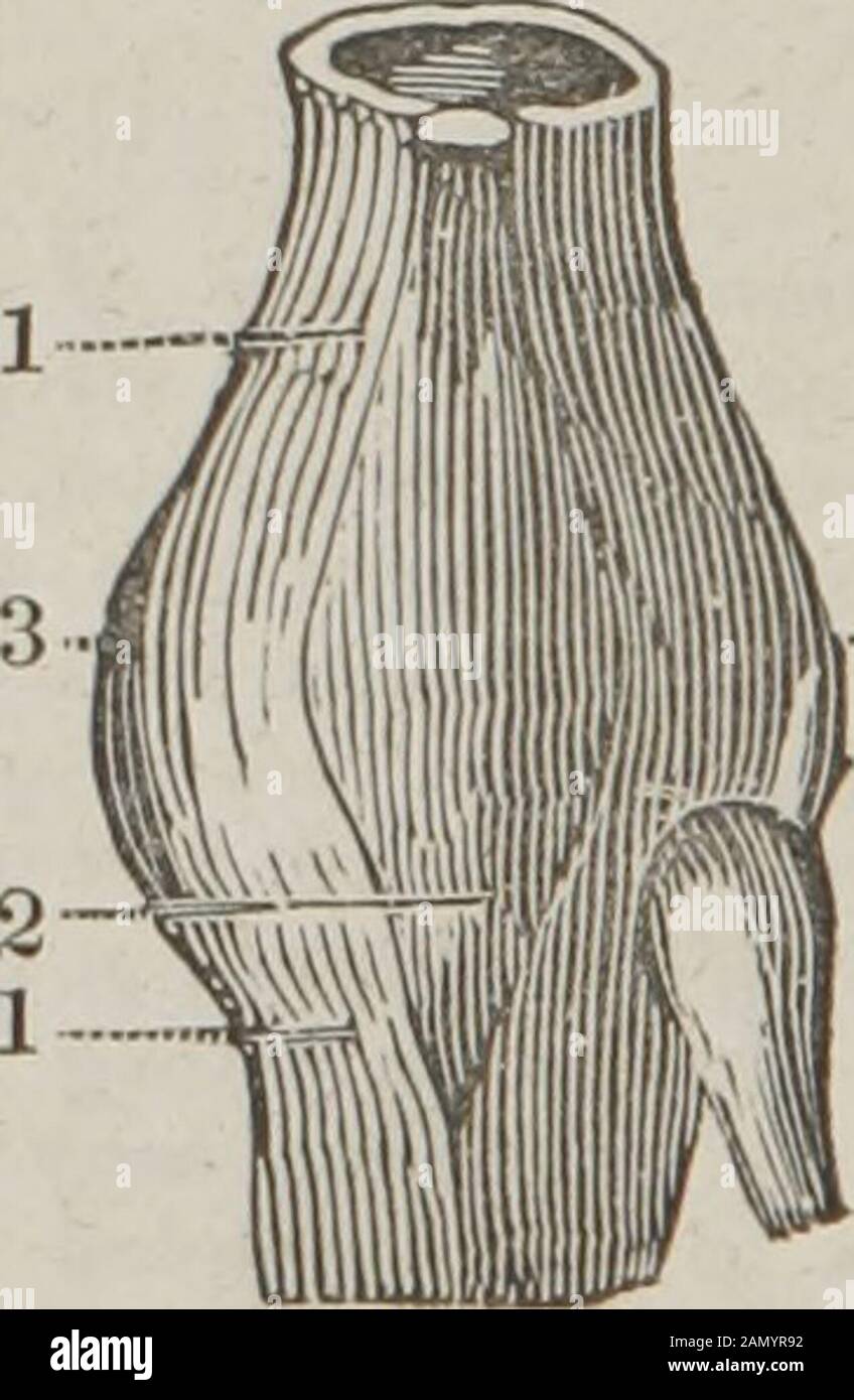 Le guide du dissecteur, ou, compagnon de l'étudiant : illustré par de nombreuses bosses, montrant clairement et expliquant la dissection de chaque partie du corps humain . ise la tête du fémur sur le bord de l'acétabulum, et il est ainsi accompli. 4. Méthode quand sur le pubis. — Le bassin étant fixé, l'extensionpeut être fait vers le haut et vers l'arrière, une serviette ayant été prémontée sous la cuisse blessée, afin de permettre à un assistant de lever la cuisse pendant l'extension, ce qui attirera la tête du fémur sur le bord de l'acétabulum. L'extension est alors à Banque D'Images