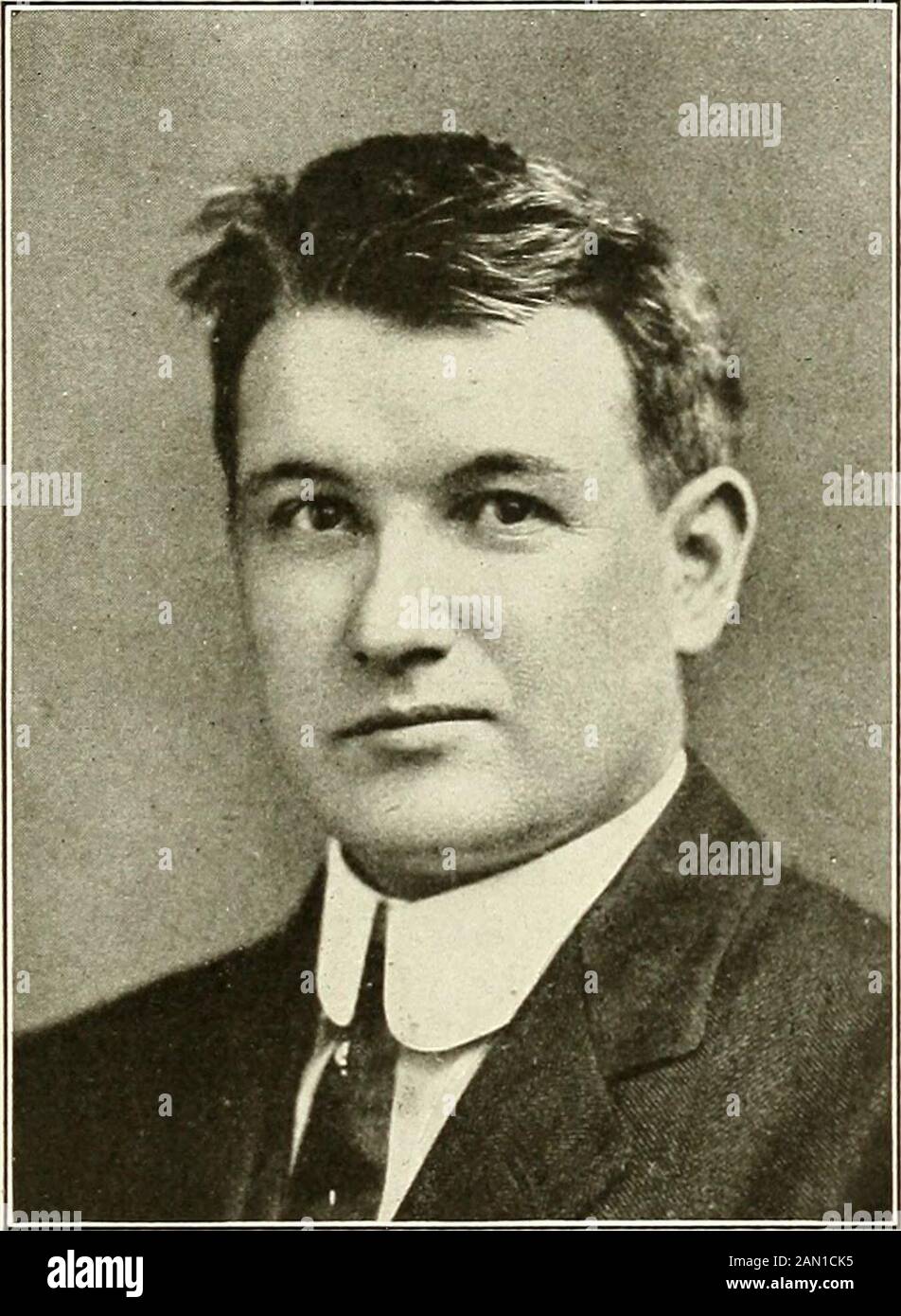 Blessures par balle : comment elles sont infligées : leurs complications et leur traitement . re fait en 1912, treize ans après la blessure. Armée Med. Collecte scolaire, Gibbs Labor-atory. Dr Leon T. Lewald, X-rayist. Appliqué, l'abcès s'est délavé et drainé; récupération complète suivie. Un skiagram a montré une balle de fusil à la base du cerveau. Le cas suivant de la guerre hispano-américaine est d'intérêt éventant puisqu'il est accompagné d'une photographie et de skiagramrecy pris. Cas 14.—Pénétration, blessure par balle de Mauser du cerveau; woundaseptique; balle non retirée. LES BLESSURES PAR BALLE DE LA TÊTE, FONT FACE À UN Banque D'Images