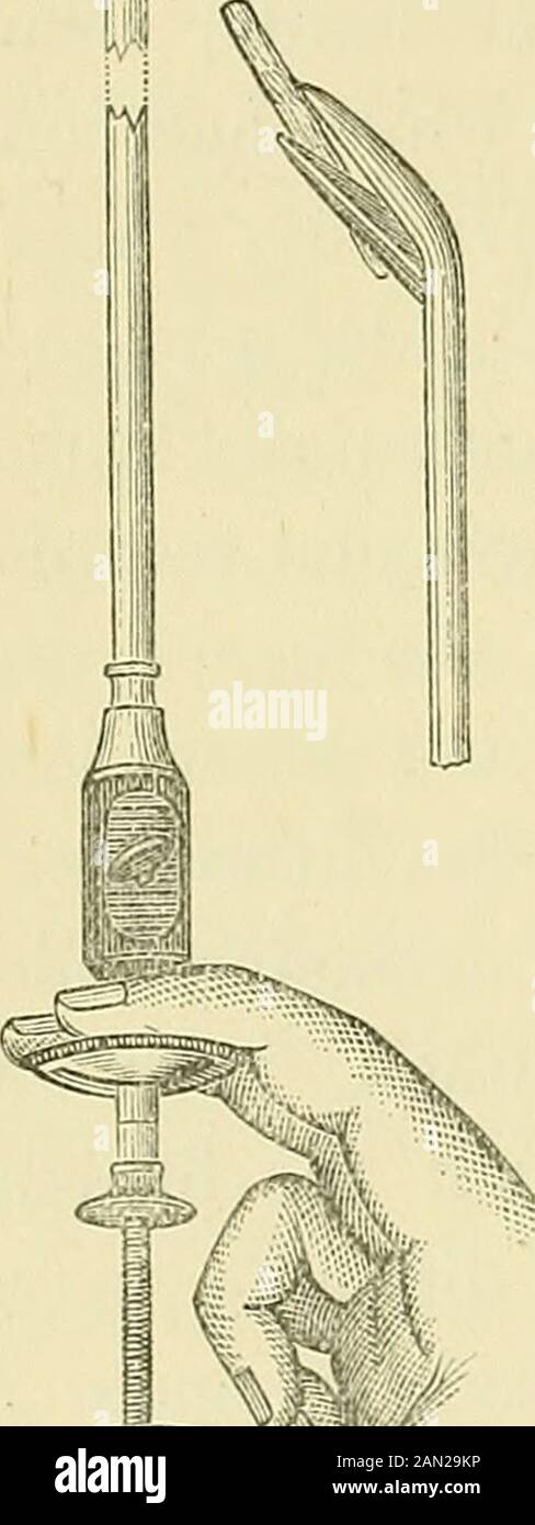 Conférences cliniques sur la sténose de l'urètre et d'autres troubles des  organes urinaires . Le dernier cas de ce genre auquel Idevra se référer est  celui où, au moyen de la thélithotrite,