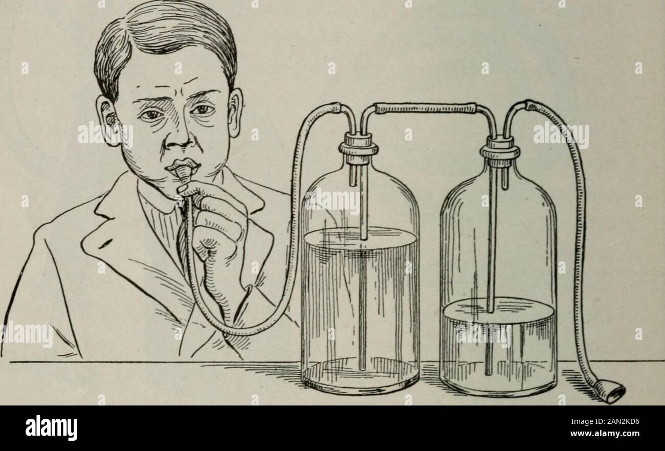 Maladies des enfants, pour les infirmières, y compris l'alimentation des nourrissons, les mesures thérapeutiques employées dans l'enfance, le traitement des urgences, la prophylaxie, l'hygiène et les soins infirmiers . Fig. 21.— Appareil d'aspiration (Kerley). L'aiguille a pénétré trop loin et est complètement passée dans la cavité. Les précautions et les perforations répétées surmontent généralement cette urgence. Traitement.—Après qu'il a été définitivement décidé thatthe cas est l'un de empyema il ya deux proceduresque le médecin peut suivre. Dans le grand nombre de cas, il fera fonctionner l'enfant. Dans un nombre de cas, il aura la pleurale Banque D'Images